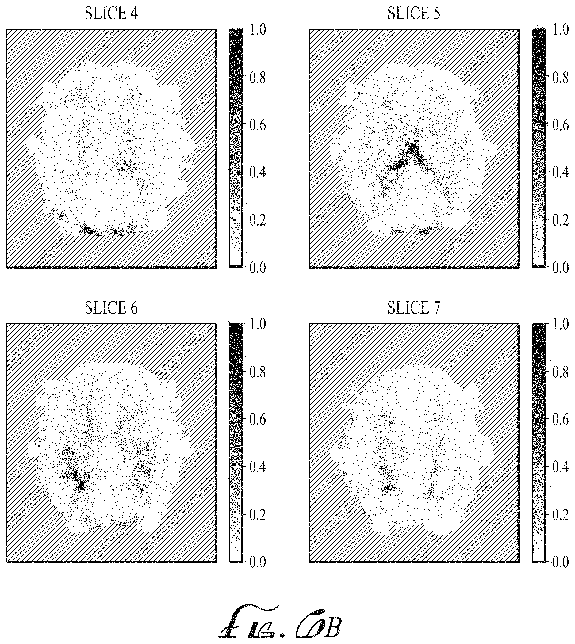 Patent US11774536 Figure 7 – Imaging biomarkers based on ratio between diffusion and perfusion