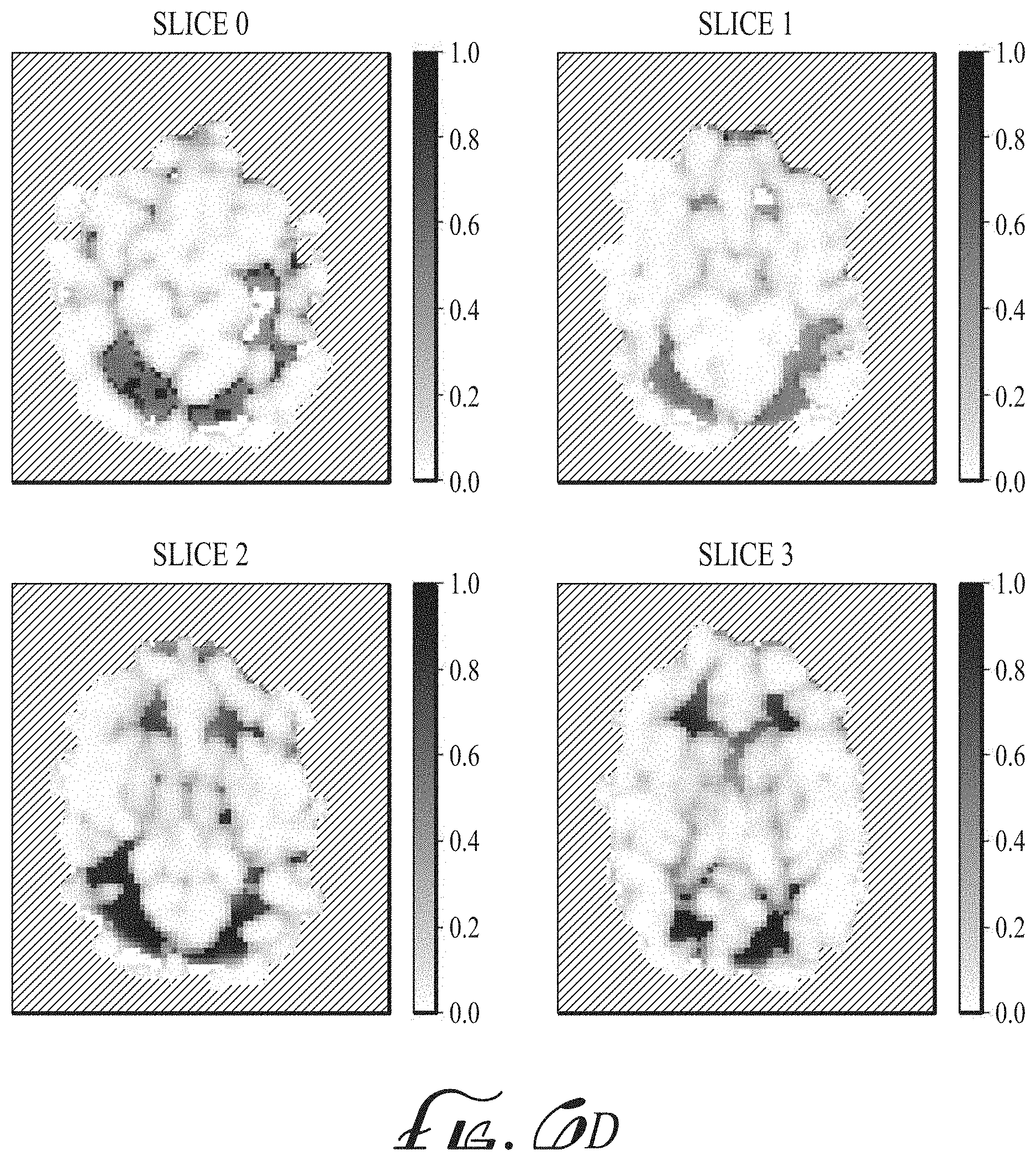 Patent US11774536 Figure 9 – Imaging biomarkers based on ratio between diffusion and perfusion