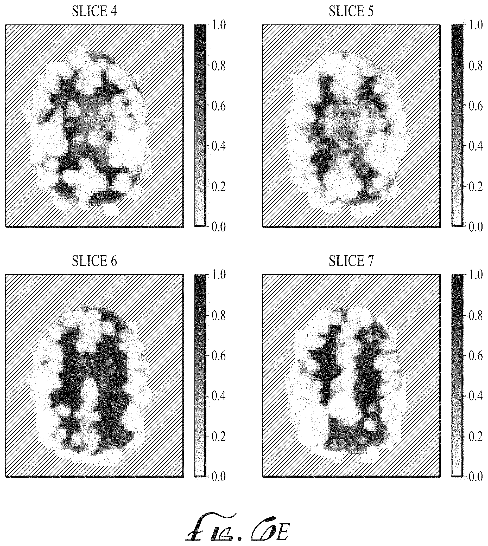 Patent US11774536 Figure 10 – Imaging biomarkers based on ratio between diffusion and perfusion
