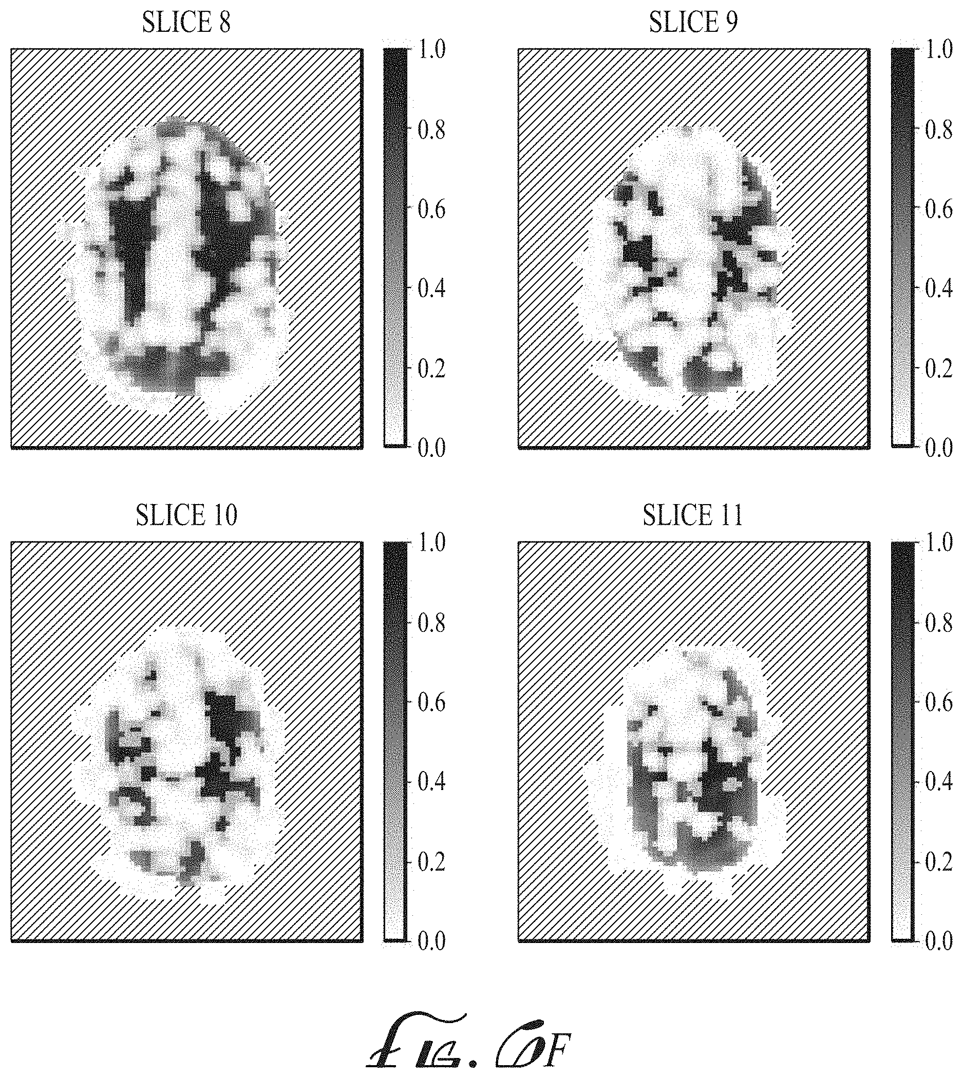 Patent US11774536 Figure 11 – Imaging biomarkers based on ratio between diffusion and perfusion