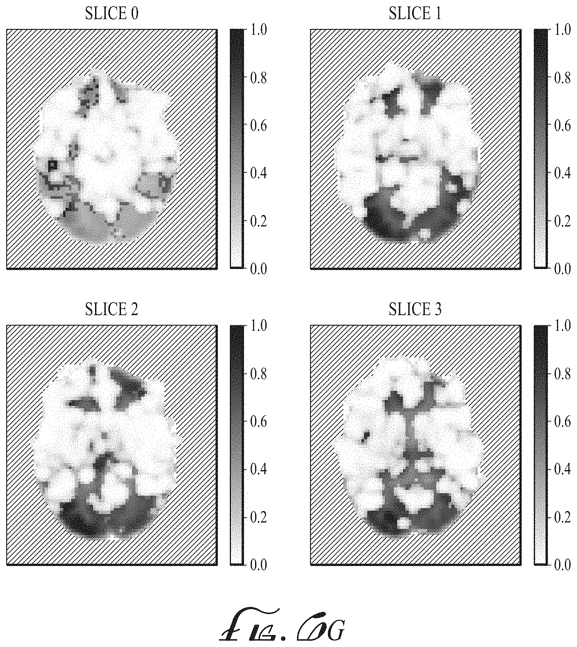 Patent US11774536 Figure 12 – Imaging biomarkers based on ratio between diffusion and perfusion
