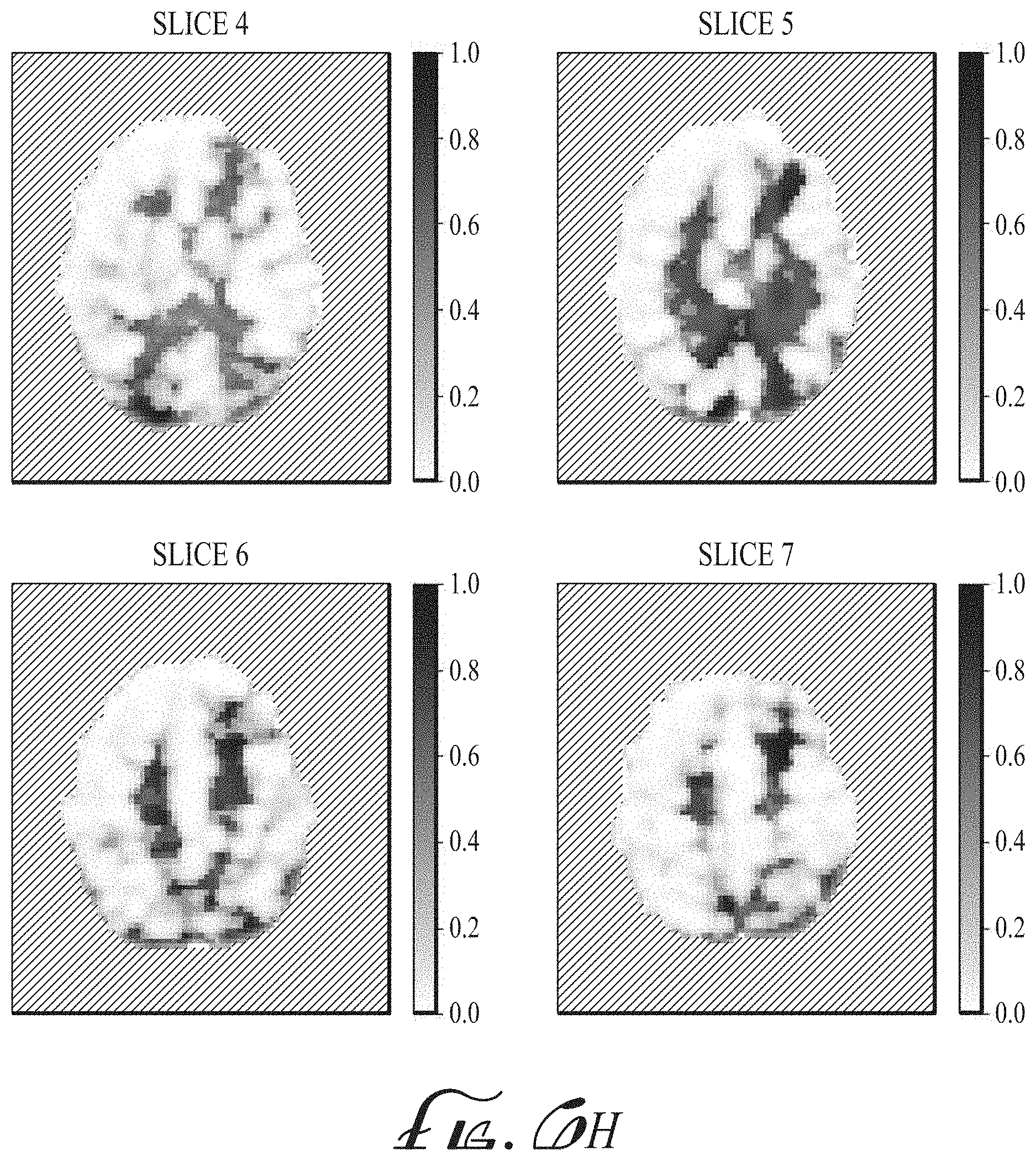 Patent US11774536 Figure 13 – Imaging biomarkers based on ratio between diffusion and perfusion