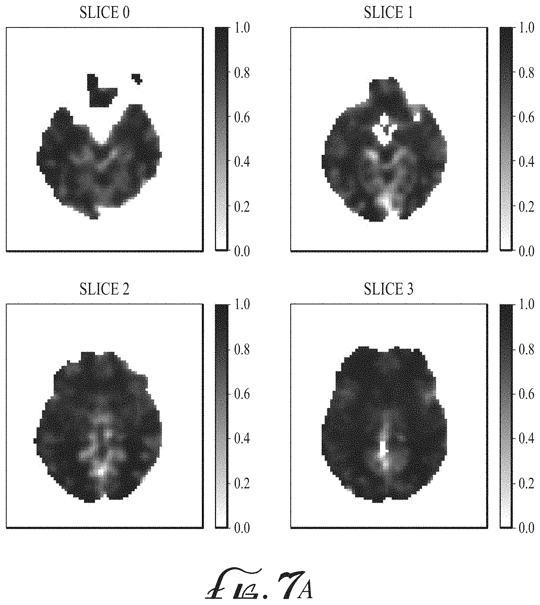 Patent US11774536 Figure 15 – Imaging biomarkers based on ratio between diffusion and perfusion