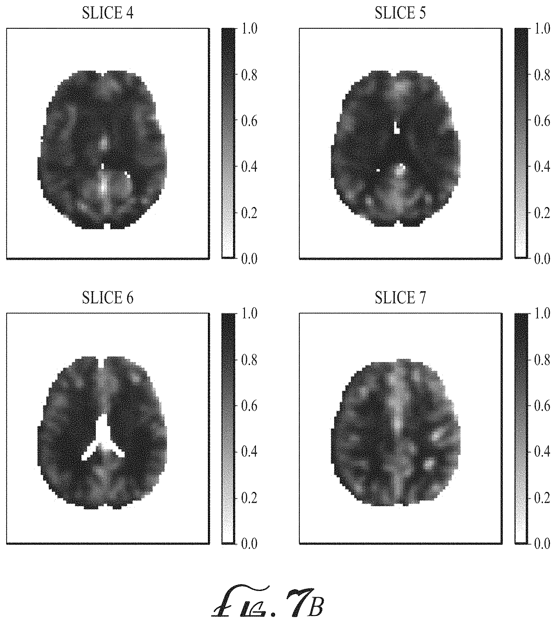 Patent US11774536 Figure 16 – Imaging biomarkers based on ratio between diffusion and perfusion