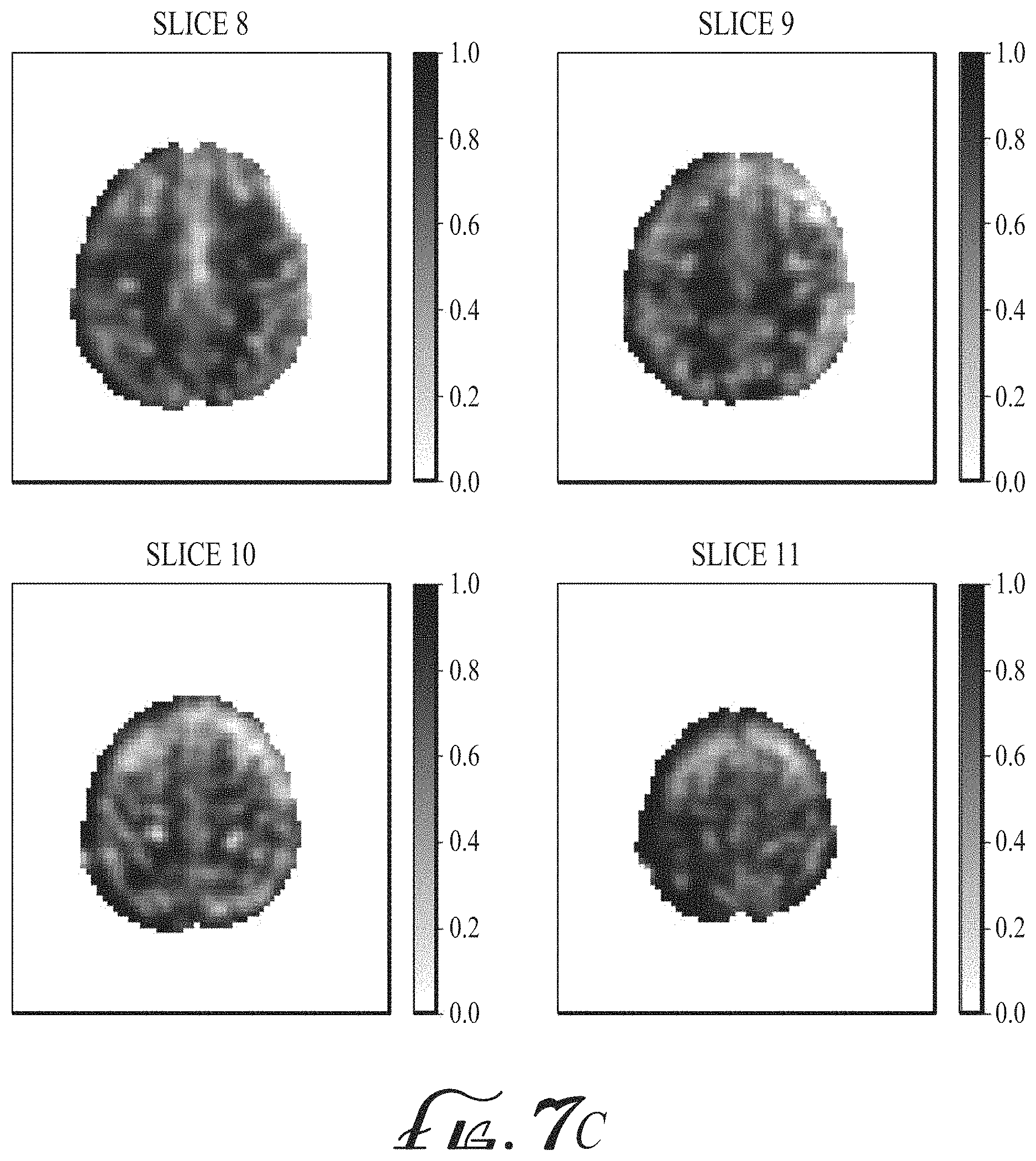 Patent US11774536 Figure 17 – Imaging biomarkers based on ratio between diffusion and perfusion