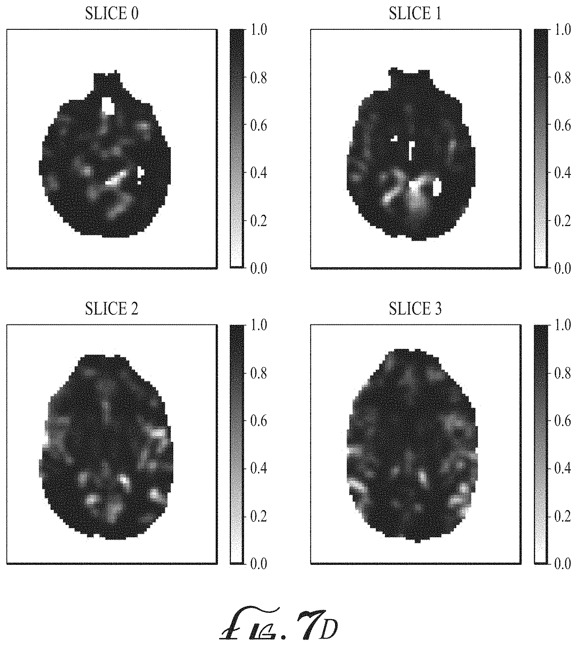 Patent US11774536 Figure 18 – Imaging biomarkers based on ratio between diffusion and perfusion
