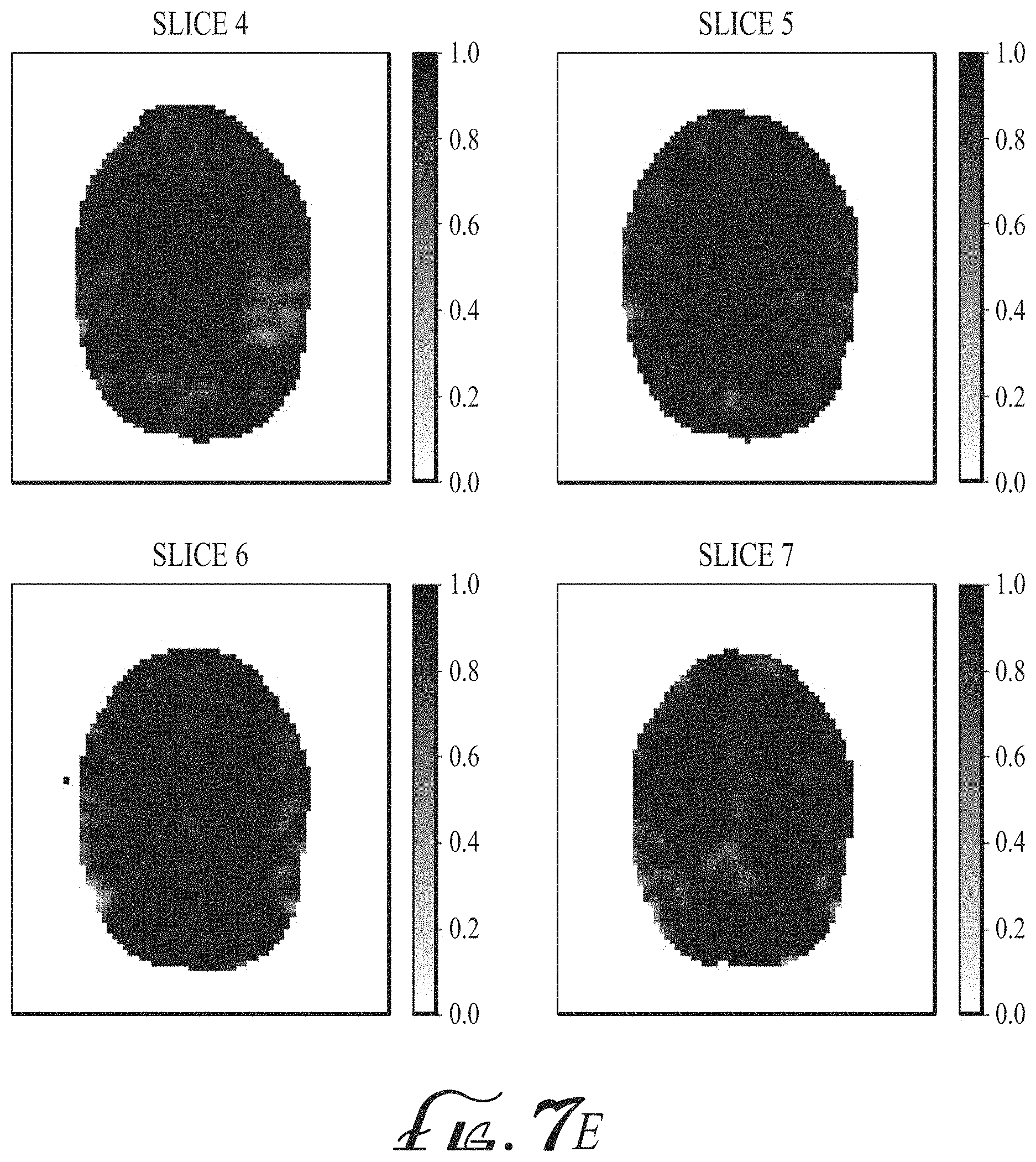 Patent US11774536 Figure 19 – Imaging biomarkers based on ratio between diffusion and perfusion