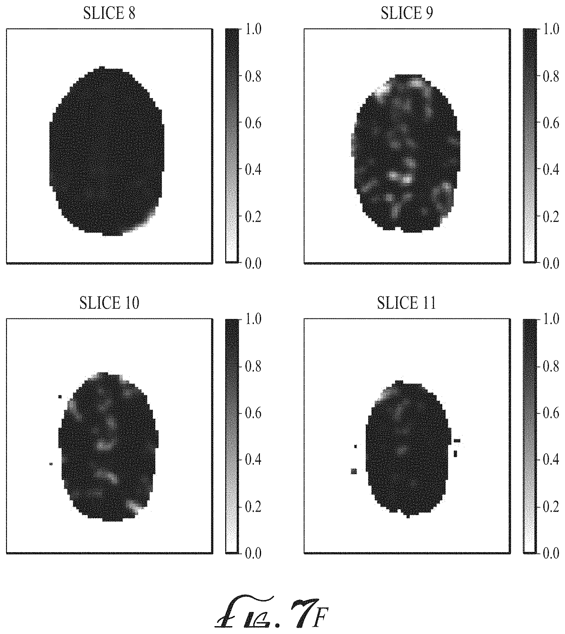 Patent US11774536 Figure 20 – Imaging biomarkers based on ratio between diffusion and perfusion