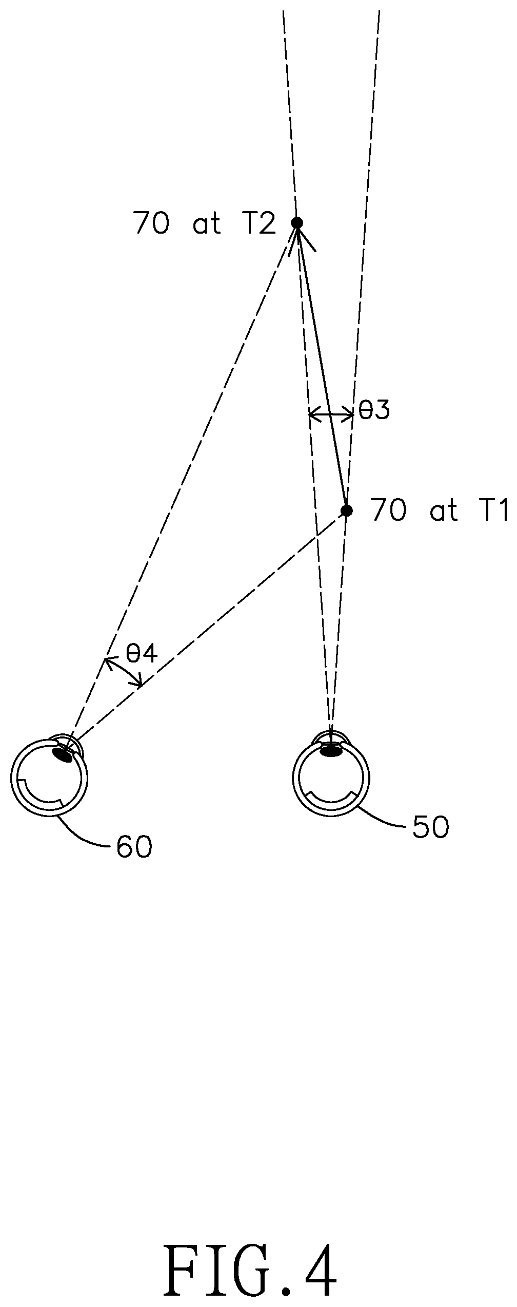 Patent US11774759 Figure 4 – Systems and methods for improving binocular vision