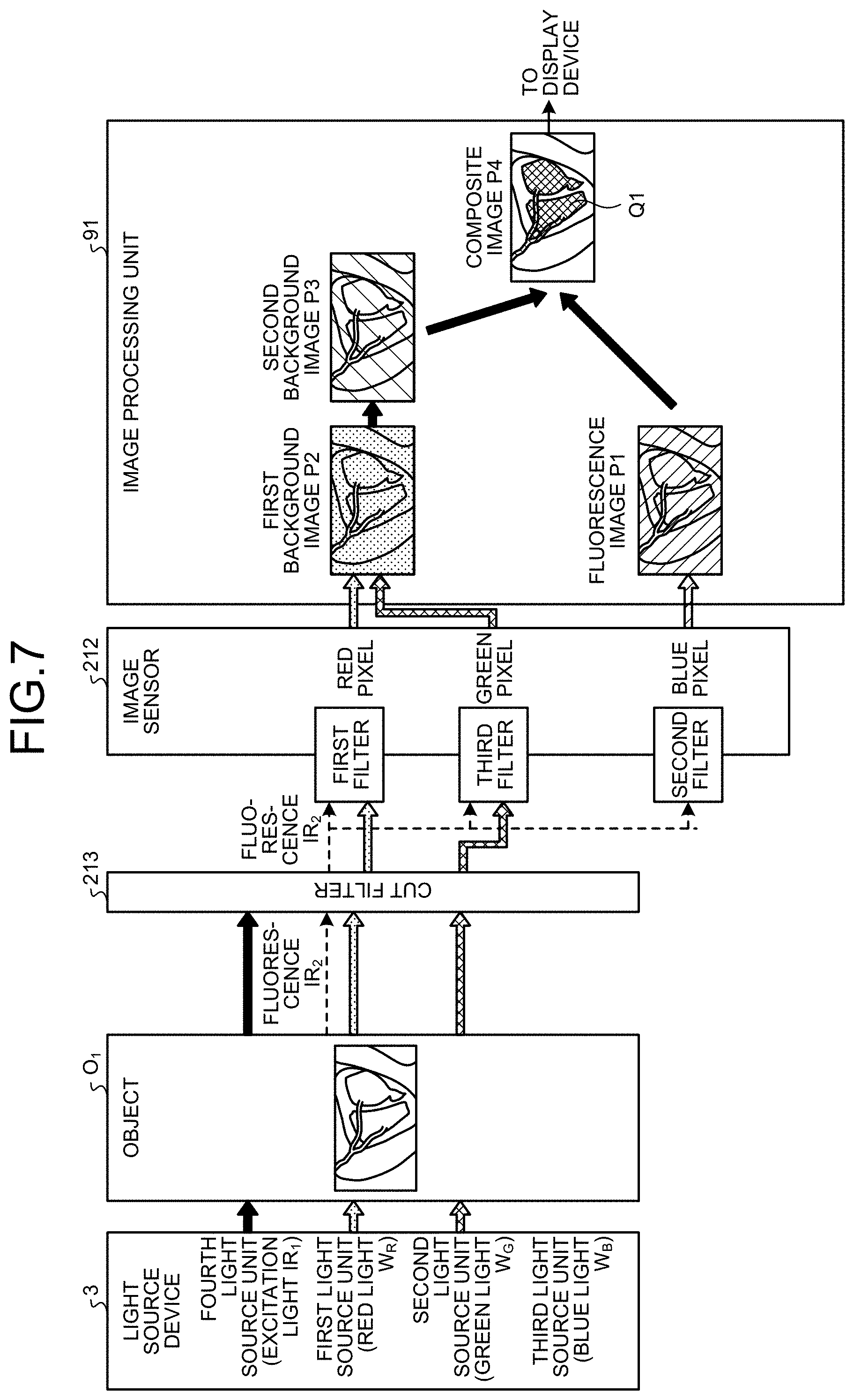Patent US11774772 Figure 6 – Medical image processing device, medical observation system, and image processing method