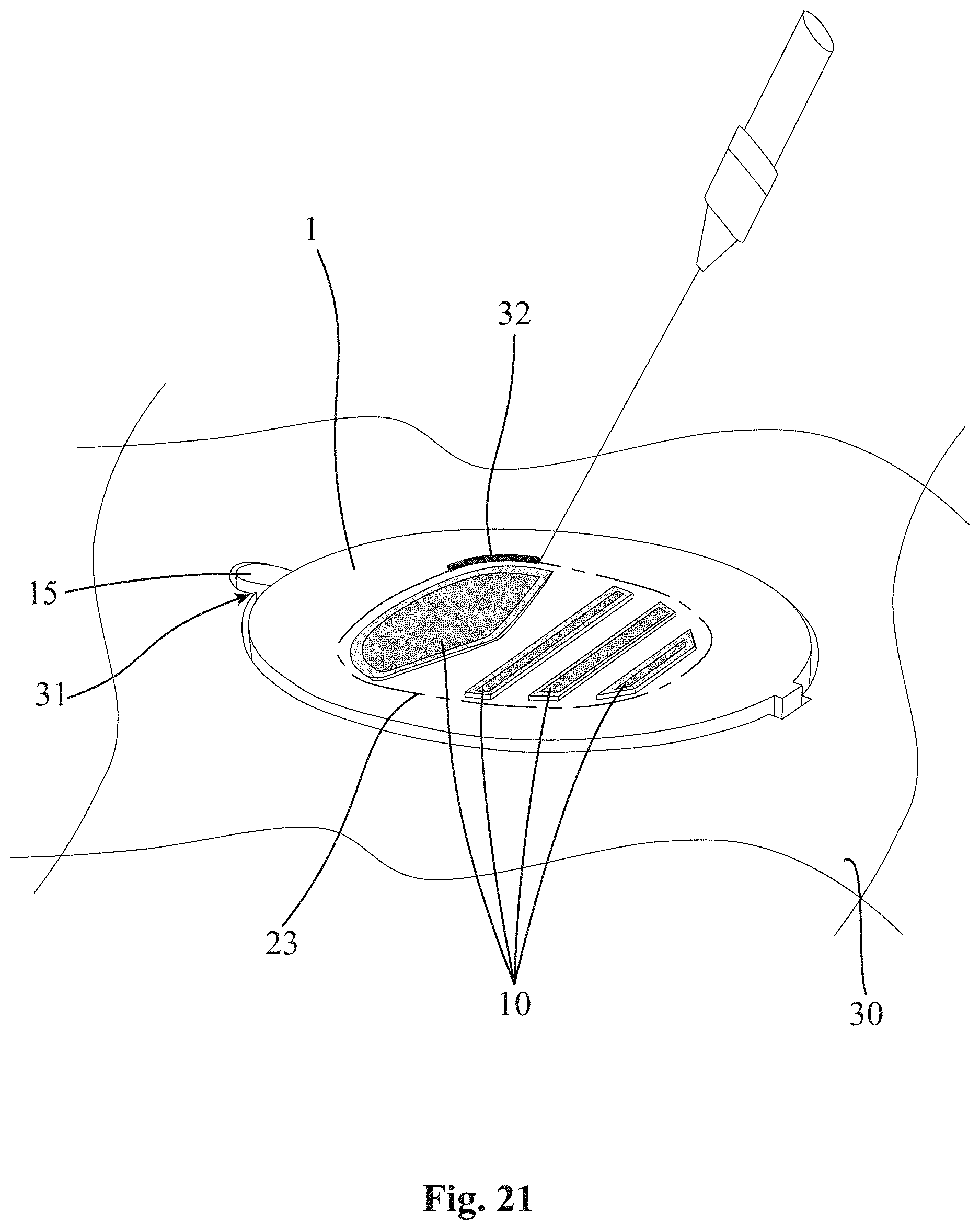 Patent US11774777 Figure 10 – Method for making an eyeglass lens coated by means of physical vapor deposition PVD