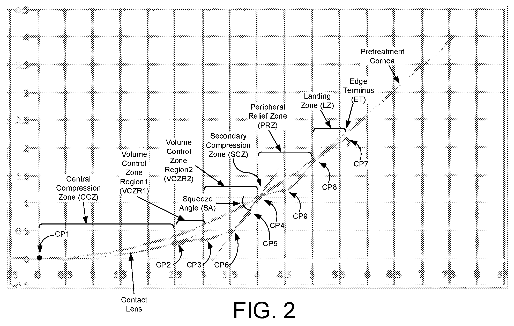 Patent US11774779 Figure 2 – Geometric volume control corneal refractive therapy contact lens