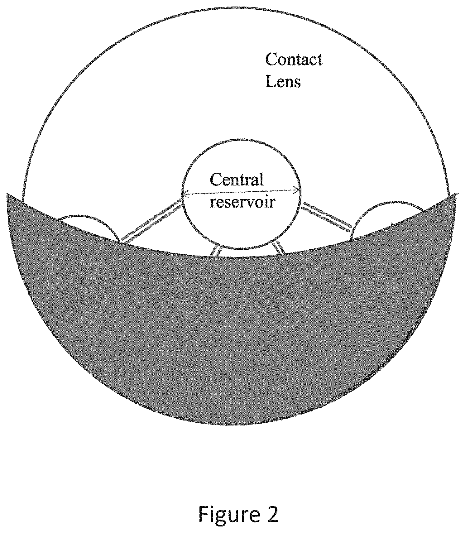 Patent US11774781 Figure 2 – Fluidic module for accommodating soft contact lens