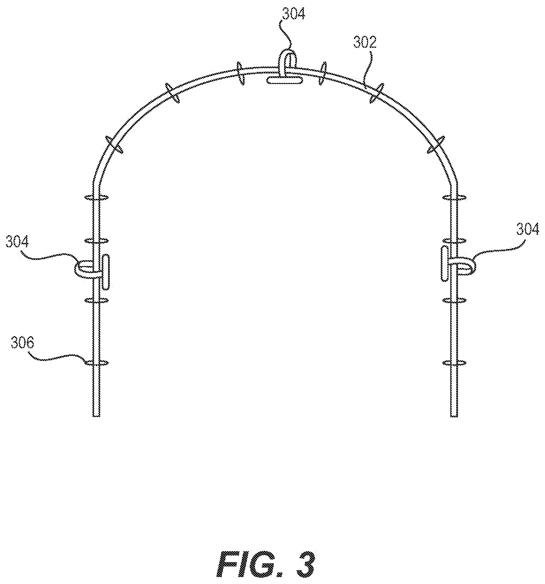 Patent US11774943 Figure 3 – Ceramic processing for the direct manufacture of customized labial and lingual orthodontic brackets