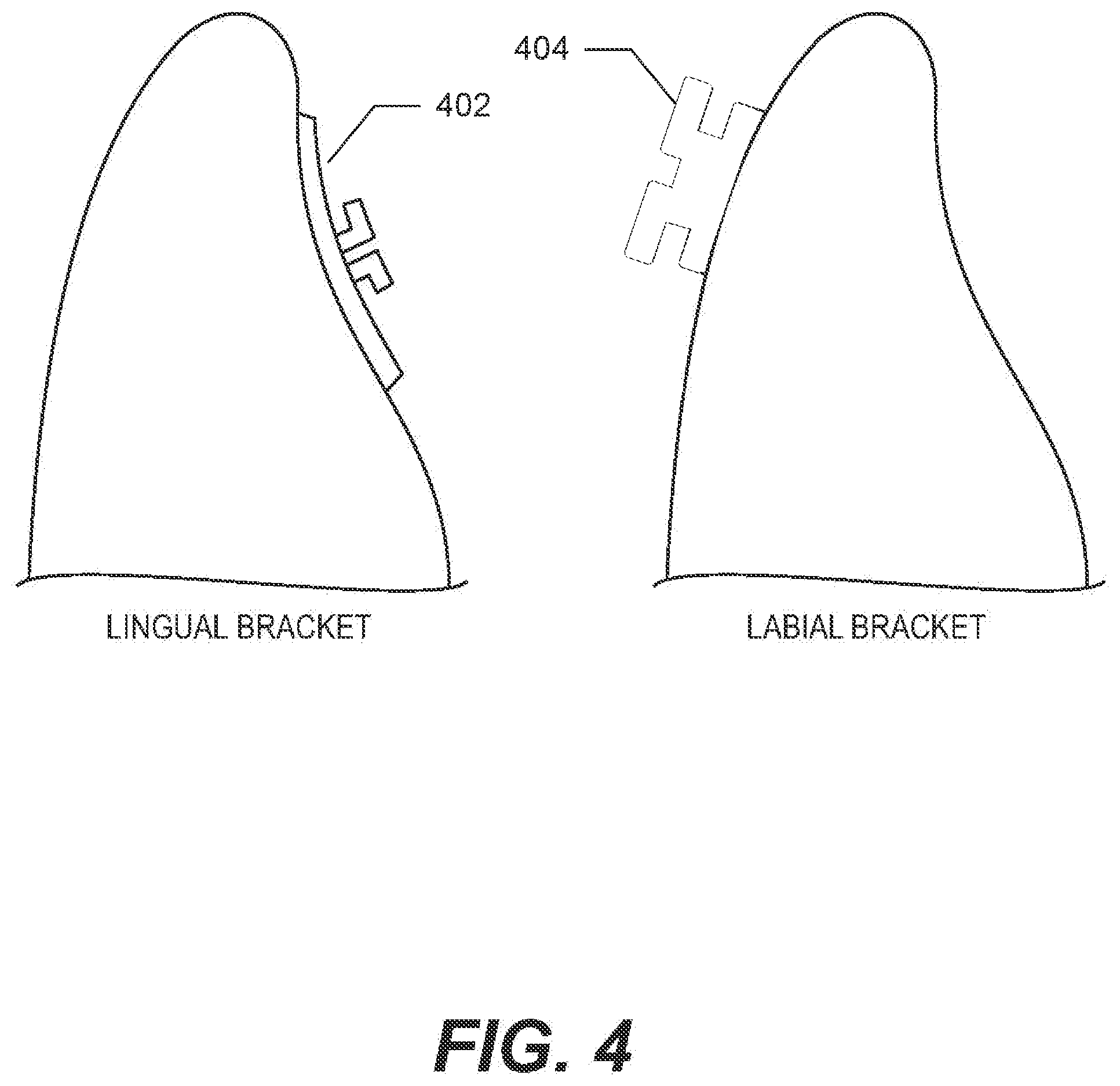 Patent US11774943 Figure 4 – Ceramic processing for the direct manufacture of customized labial and lingual orthodontic brackets