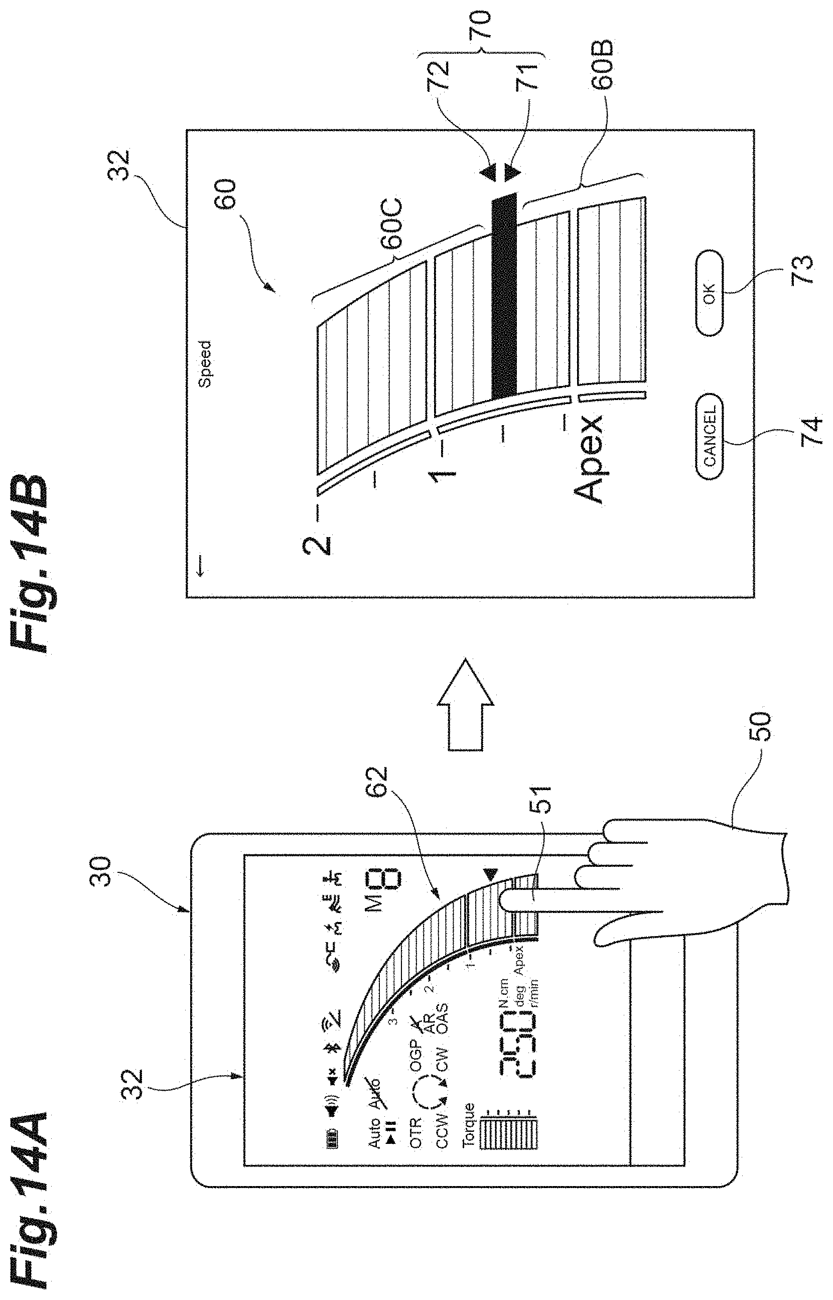 Patent US11775069 Figure 14 – Remote control device for medical system
