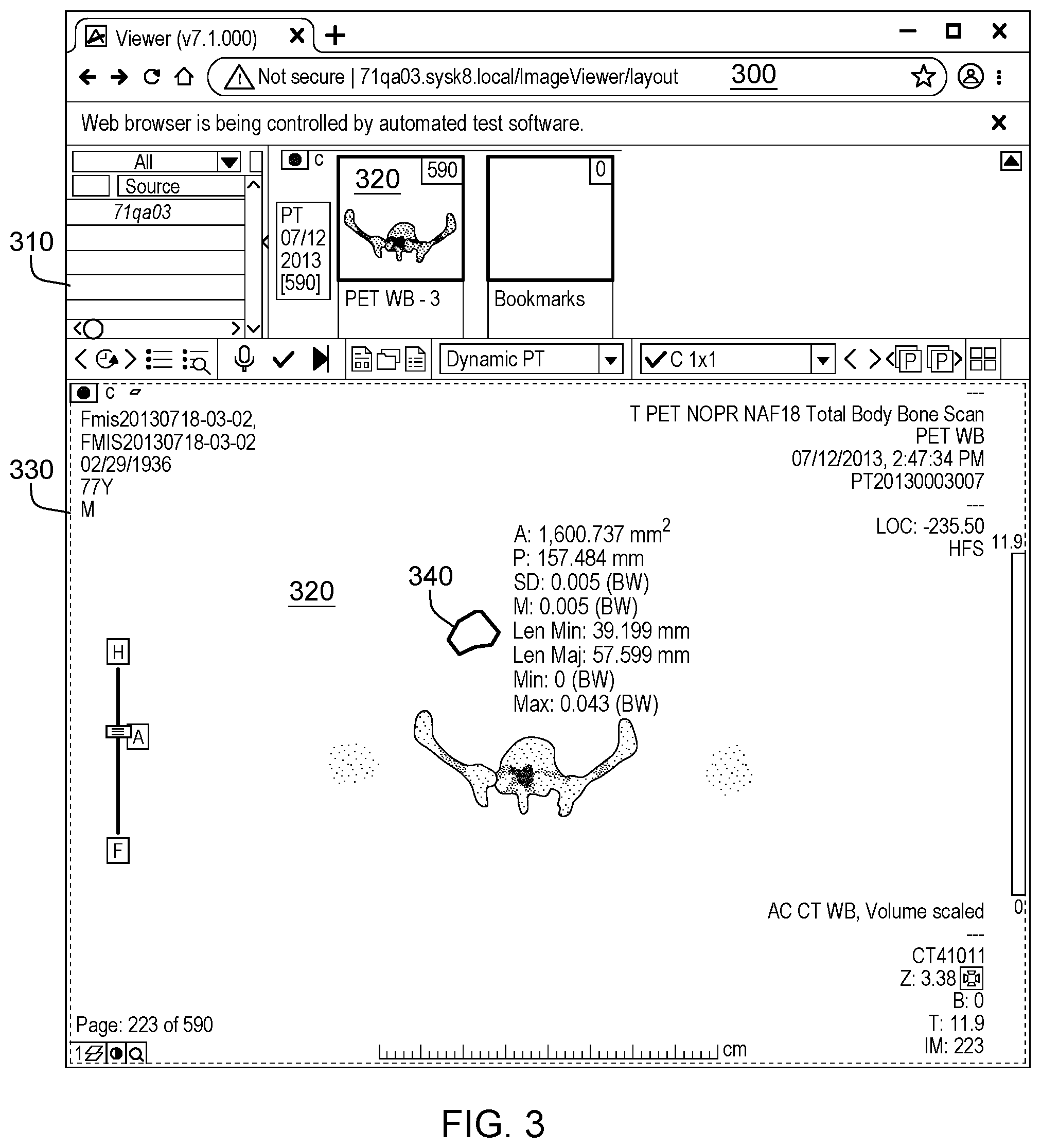 Patent US11775153 Figure 3 – Assessing measurement errors in software calculations