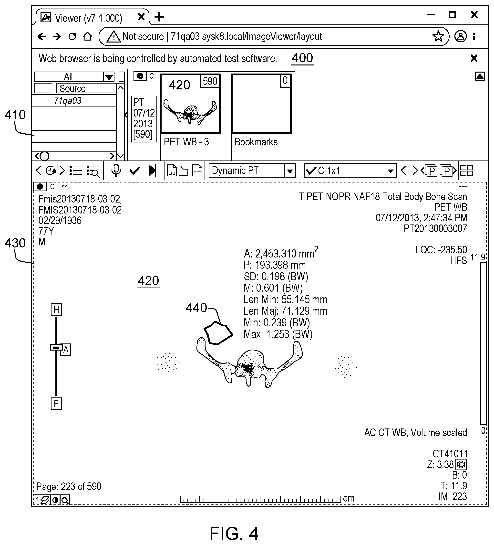 Patent US11775153 Figure 4 – Assessing measurement errors in software calculations