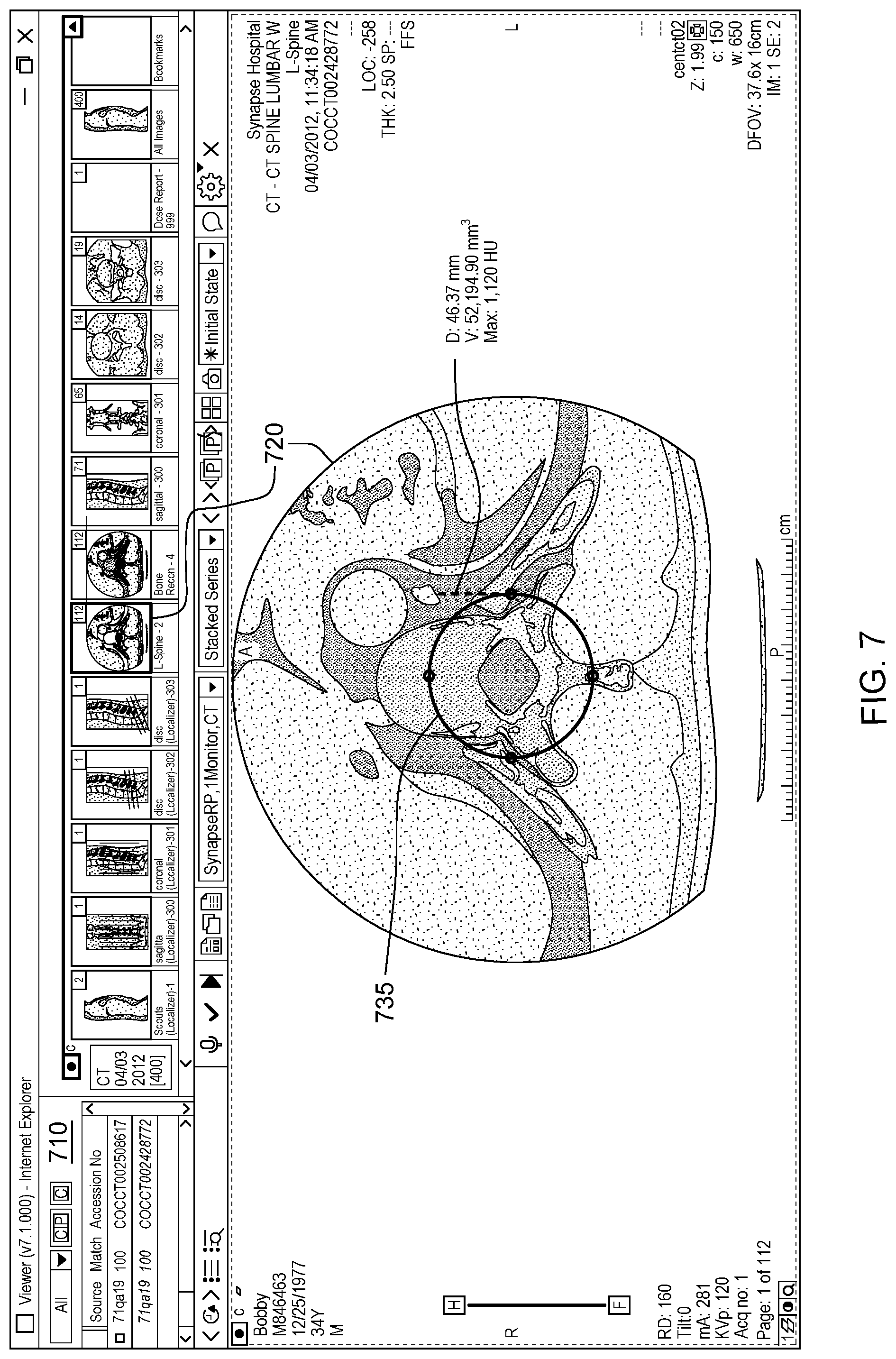 Patent US11775153 Figure 7 – Assessing measurement errors in software calculations
