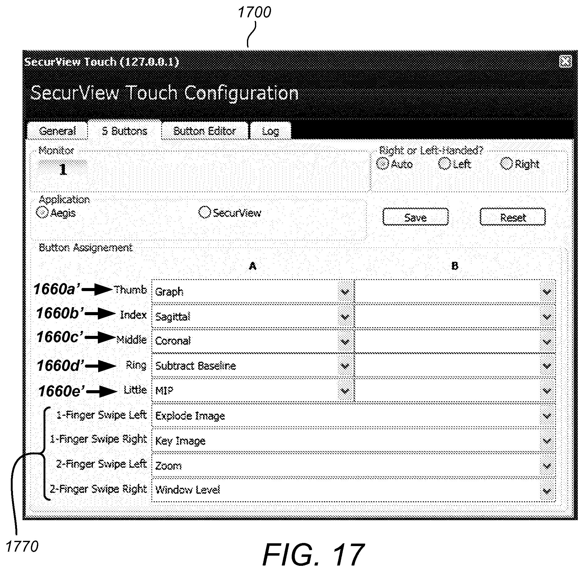 Patent US11775156 Figure 17 – User interface for medical image review workstation