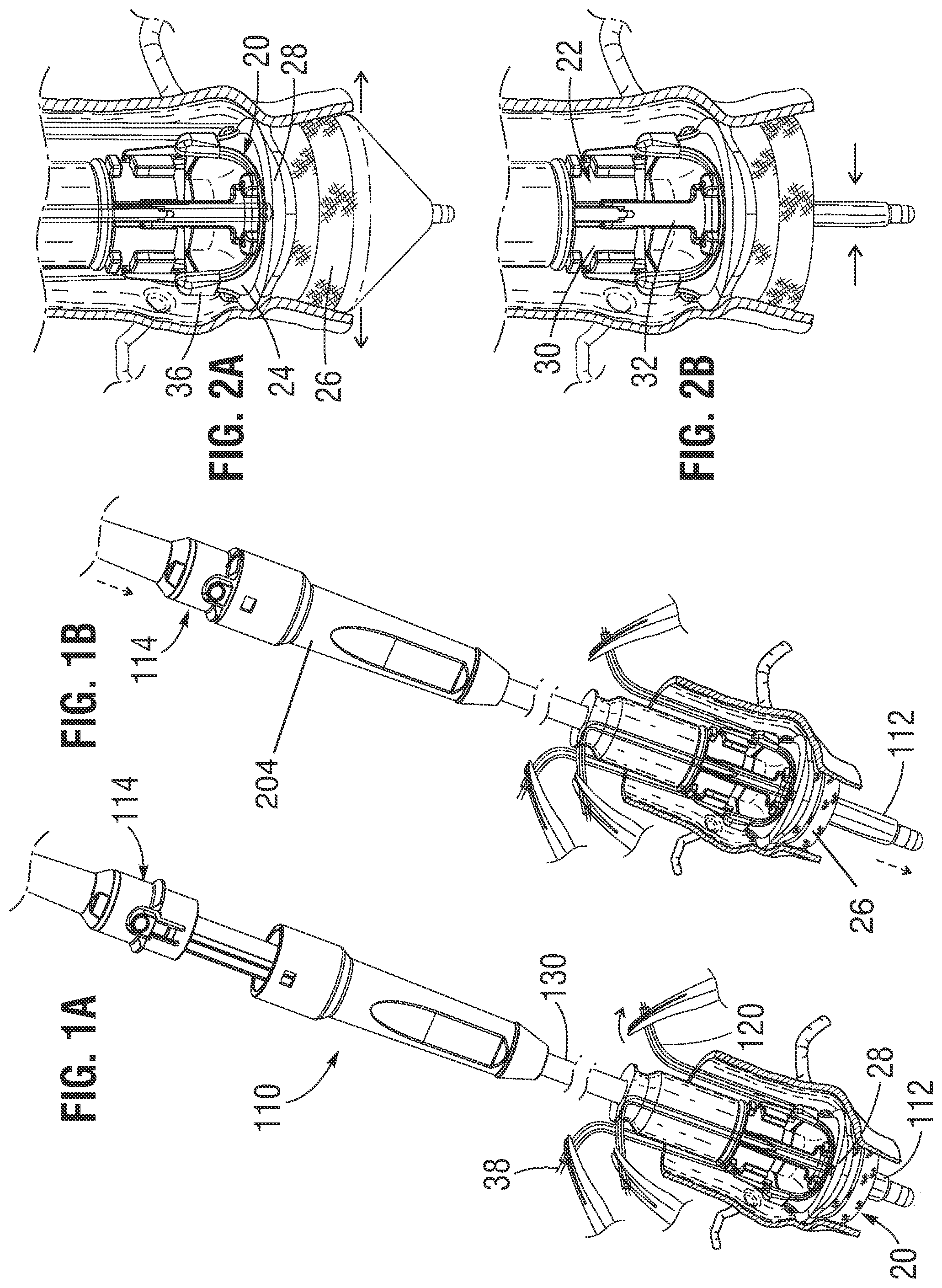 Patent US11775613 Figure 1 – Methods of safely expanding prosthetic heart valves