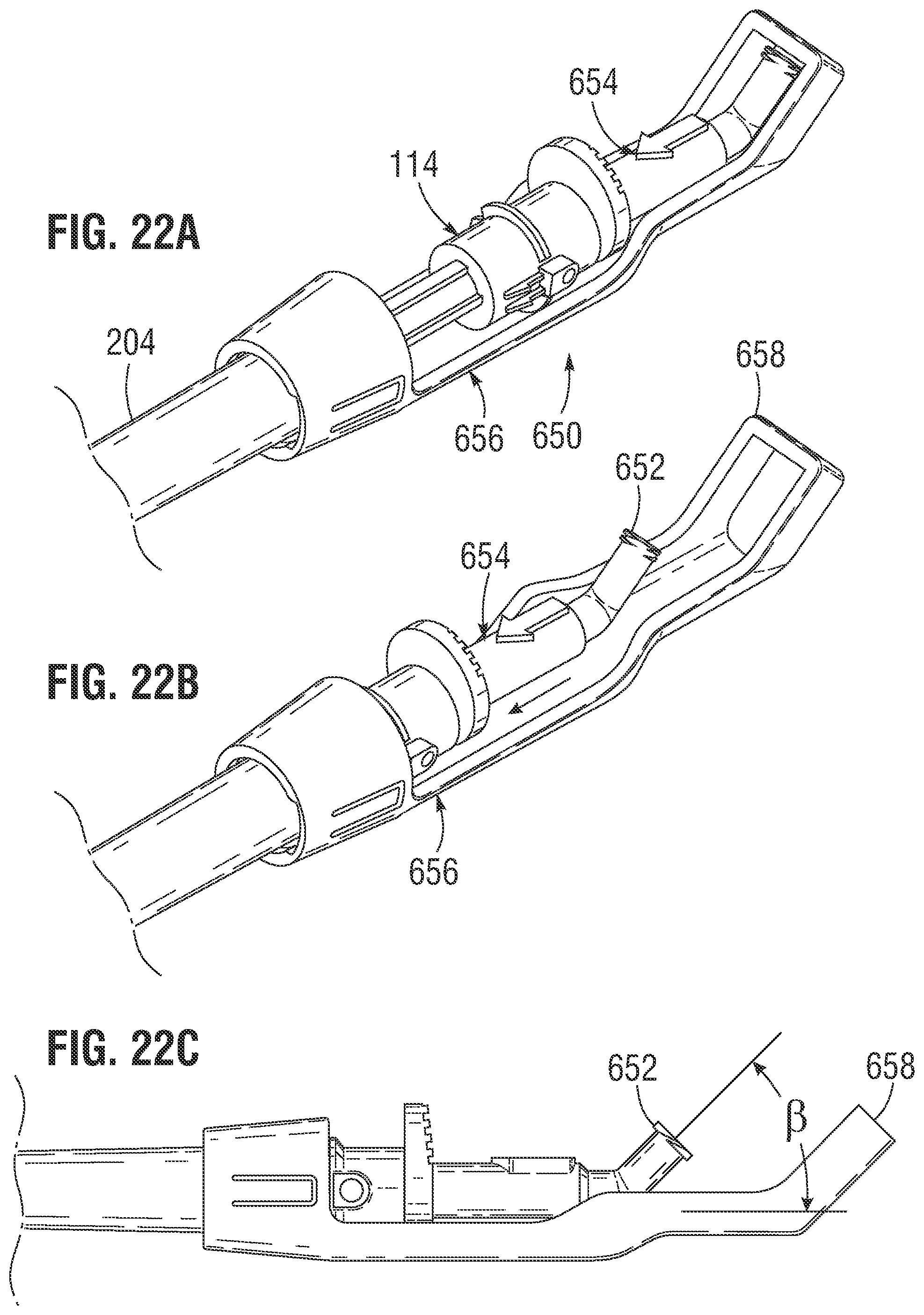Patent US11775613 Figure 15 – Methods of safely expanding prosthetic heart valves