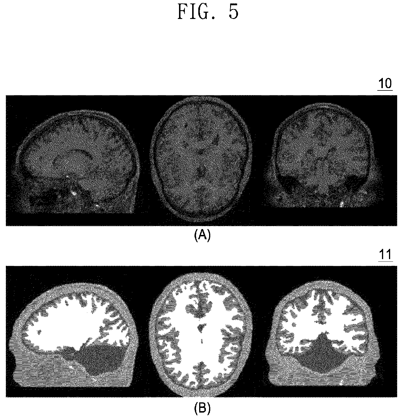 Patent US11775698 Figure 3 – Method, server and computer program for designing customized headgear for transcranial direct current stimulation