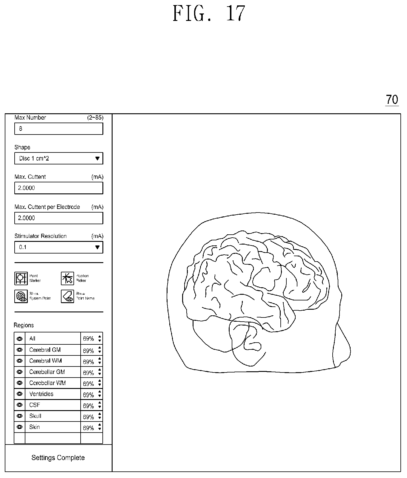 Patent US11775698 Figure 13 – Method, server and computer program for designing customized headgear for transcranial direct current stimulation