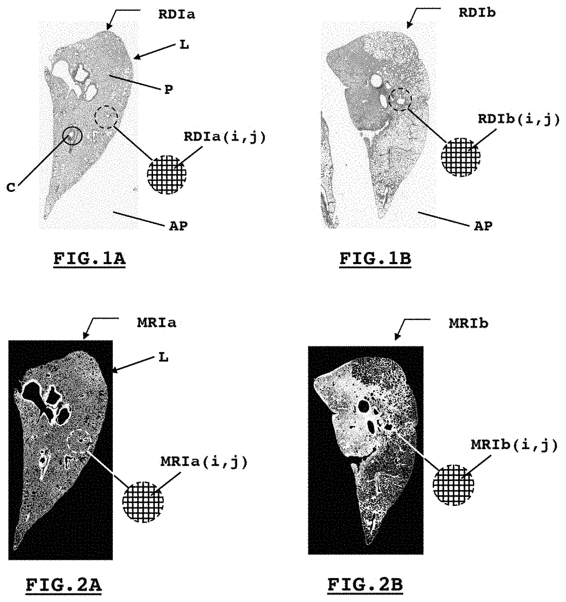 Patent US11776115 Figure 1 – System and method for estimating a quantity of interest based on an image of a histological section