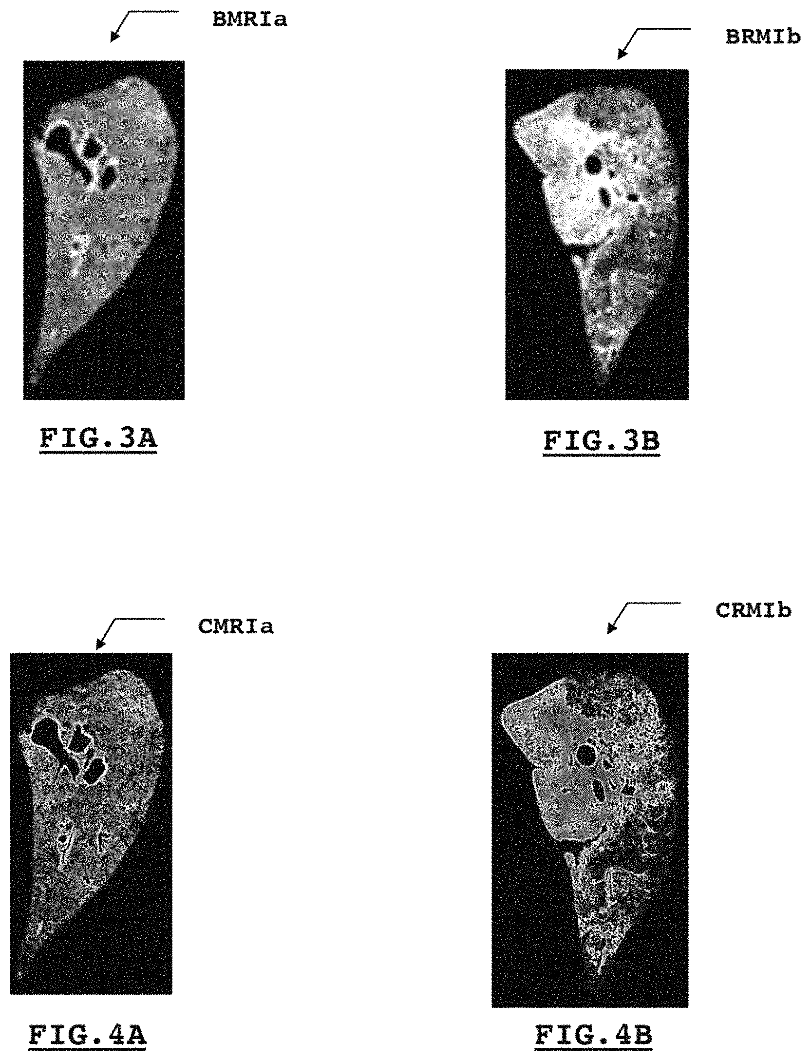 Patent US11776115 Figure 2 – System and method for estimating a quantity of interest based on an image of a histological section