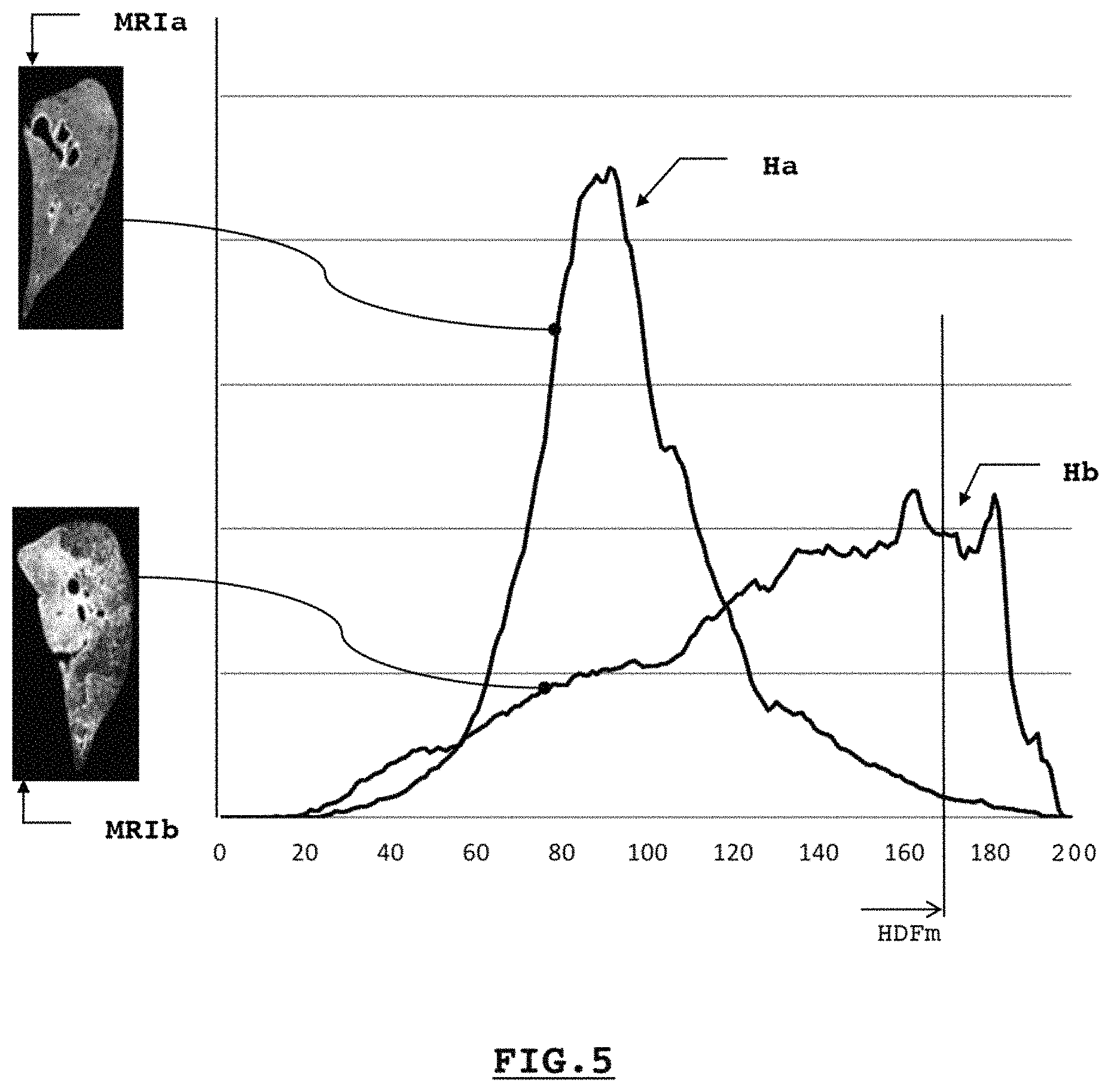 Patent US11776115 Figure 3 – System and method for estimating a quantity of interest based on an image of a histological section