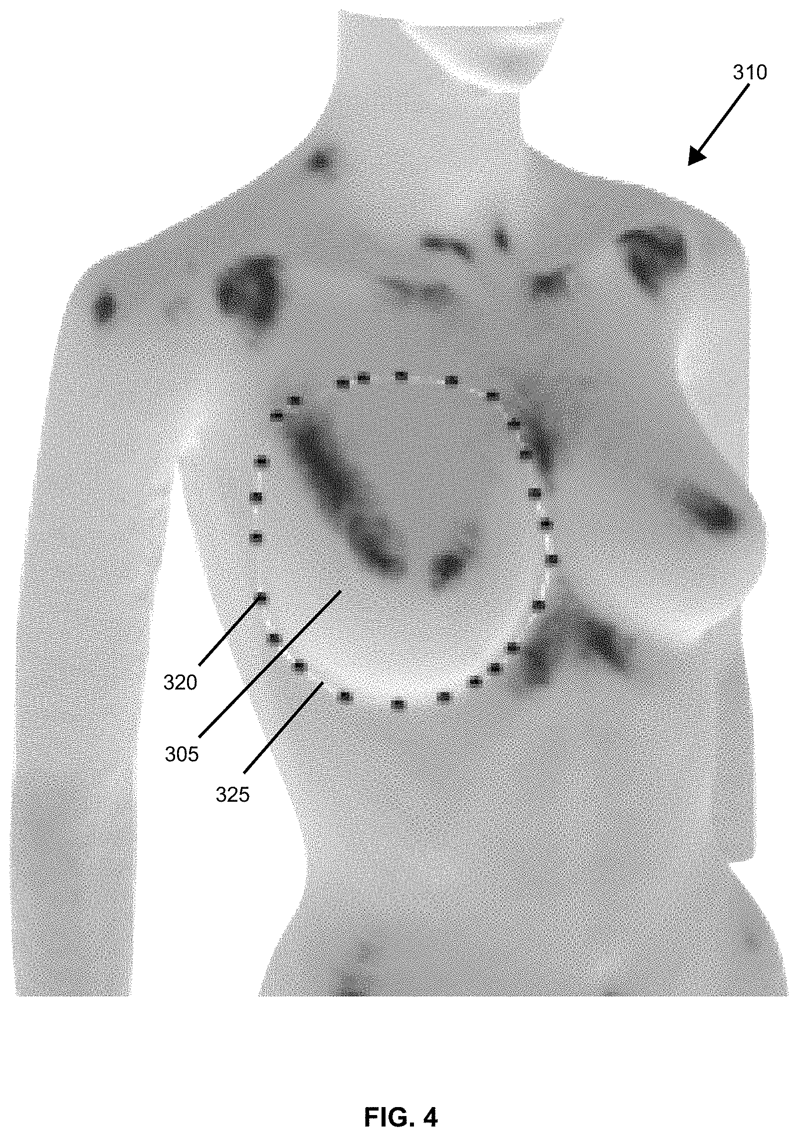 Patent US11776116 Figure 4 – System and method of high precision anatomical measurements of features of living organisms including visible contoured shapes