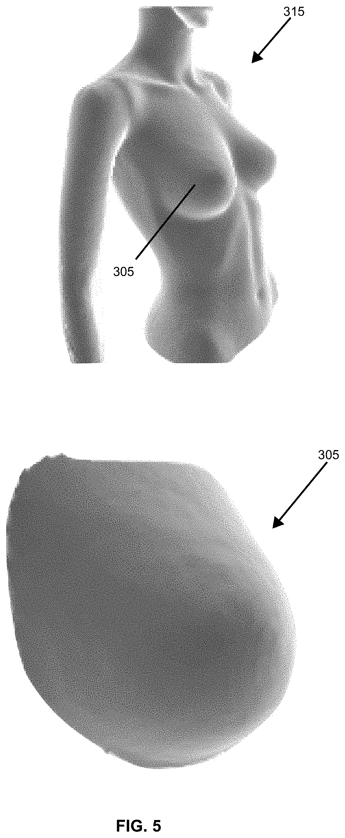 Patent US11776116 Figure 5 – System and method of high precision anatomical measurements of features of living organisms including visible contoured shapes