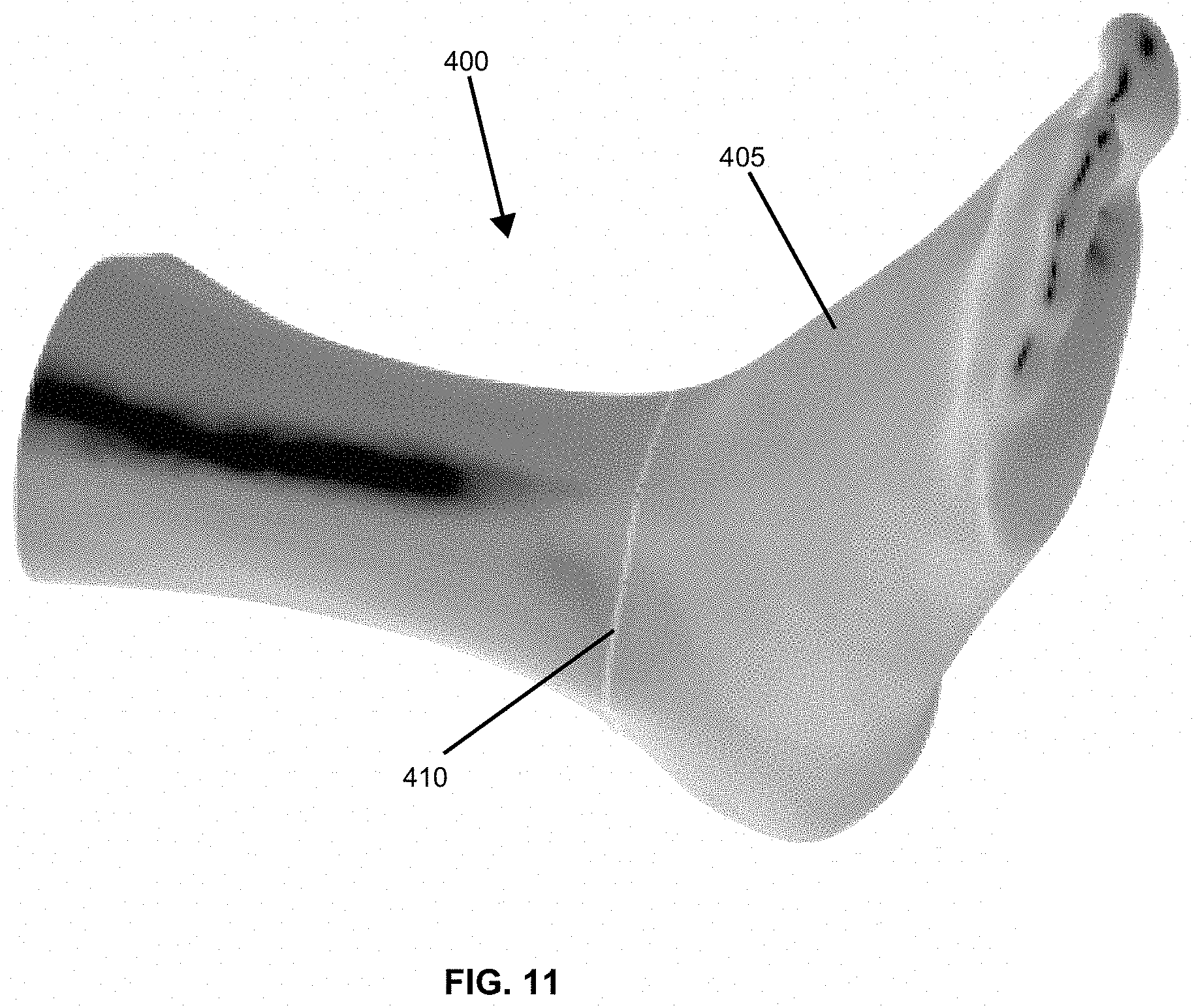 Patent US11776116 Figure 11 – System and method of high precision anatomical measurements of features of living organisms including visible contoured shapes