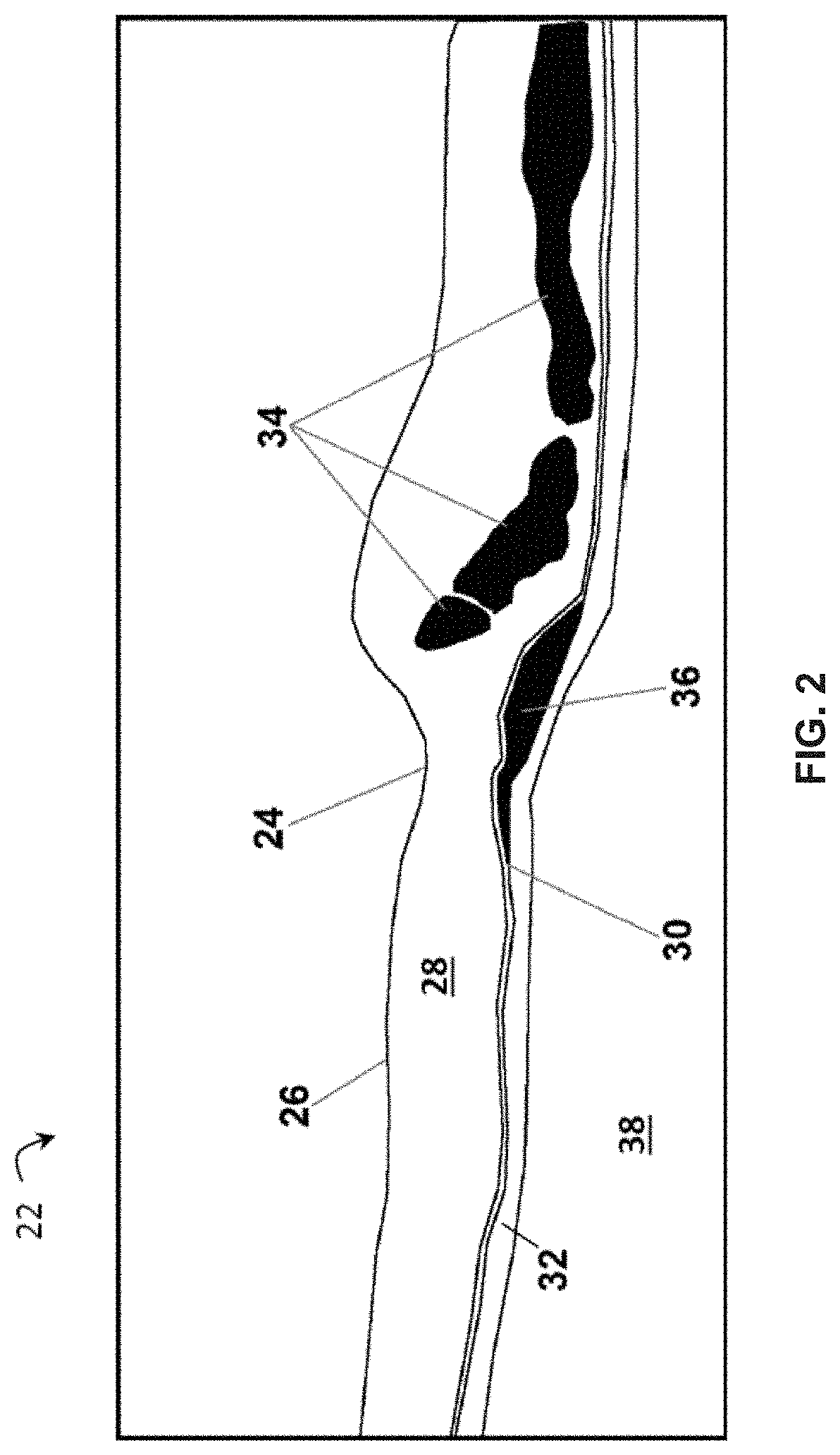 Patent US11776119 Figure 2 – Confidence-based method and system for analyzing images of a retina