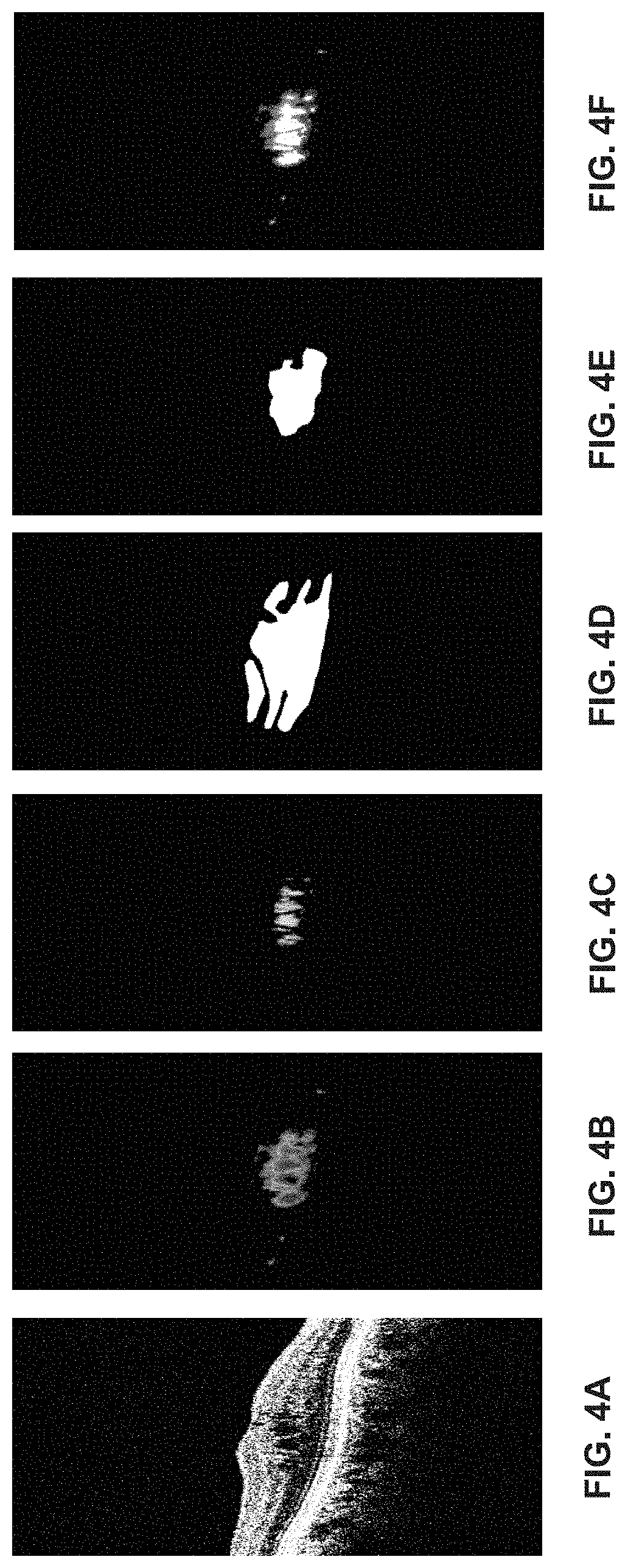 Patent US11776119 Figure 5 – Confidence-based method and system for analyzing images of a retina