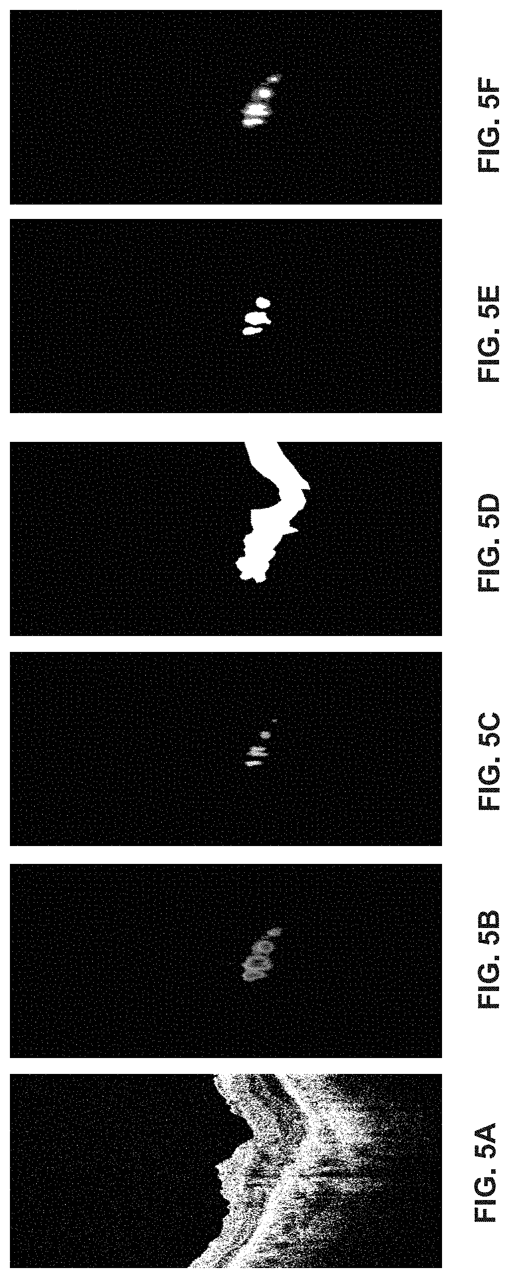 Patent US11776119 Figure 6 – Confidence-based method and system for analyzing images of a retina