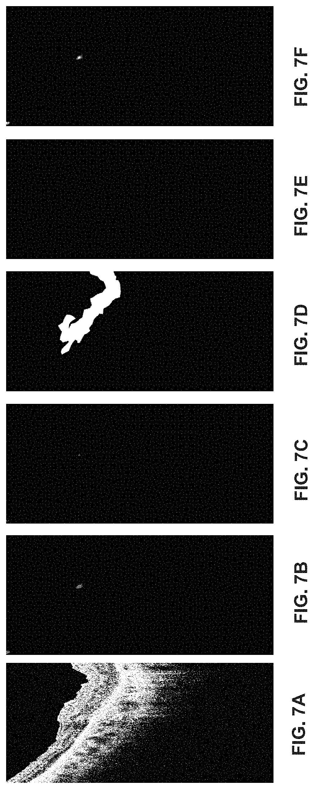 Patent US11776119 Figure 8 – Confidence-based method and system for analyzing images of a retina
