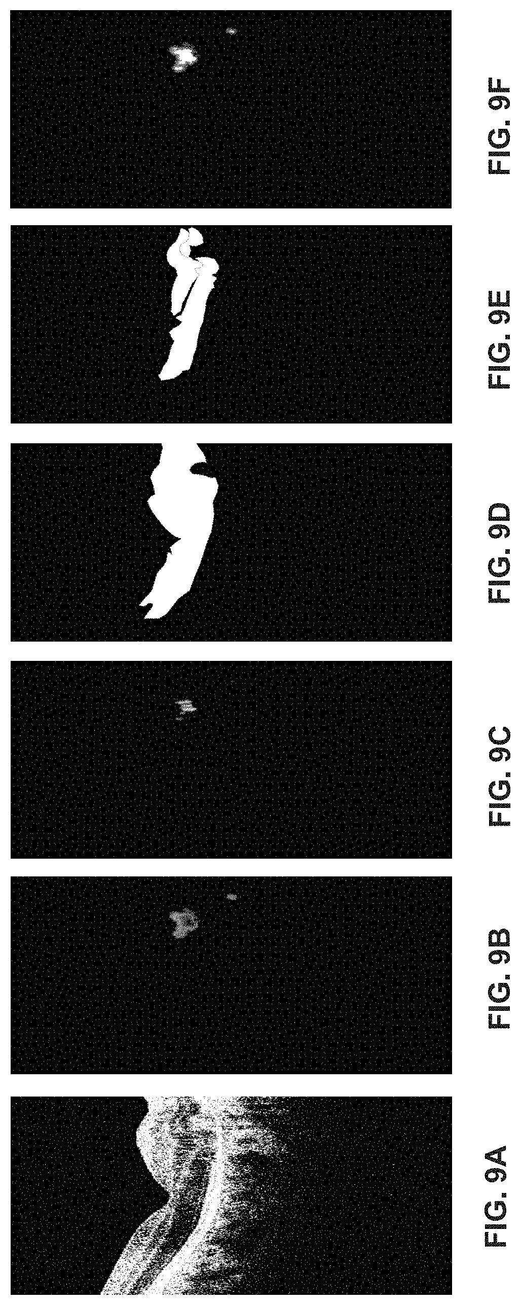 Patent US11776119 Figure 10 – Confidence-based method and system for analyzing images of a retina