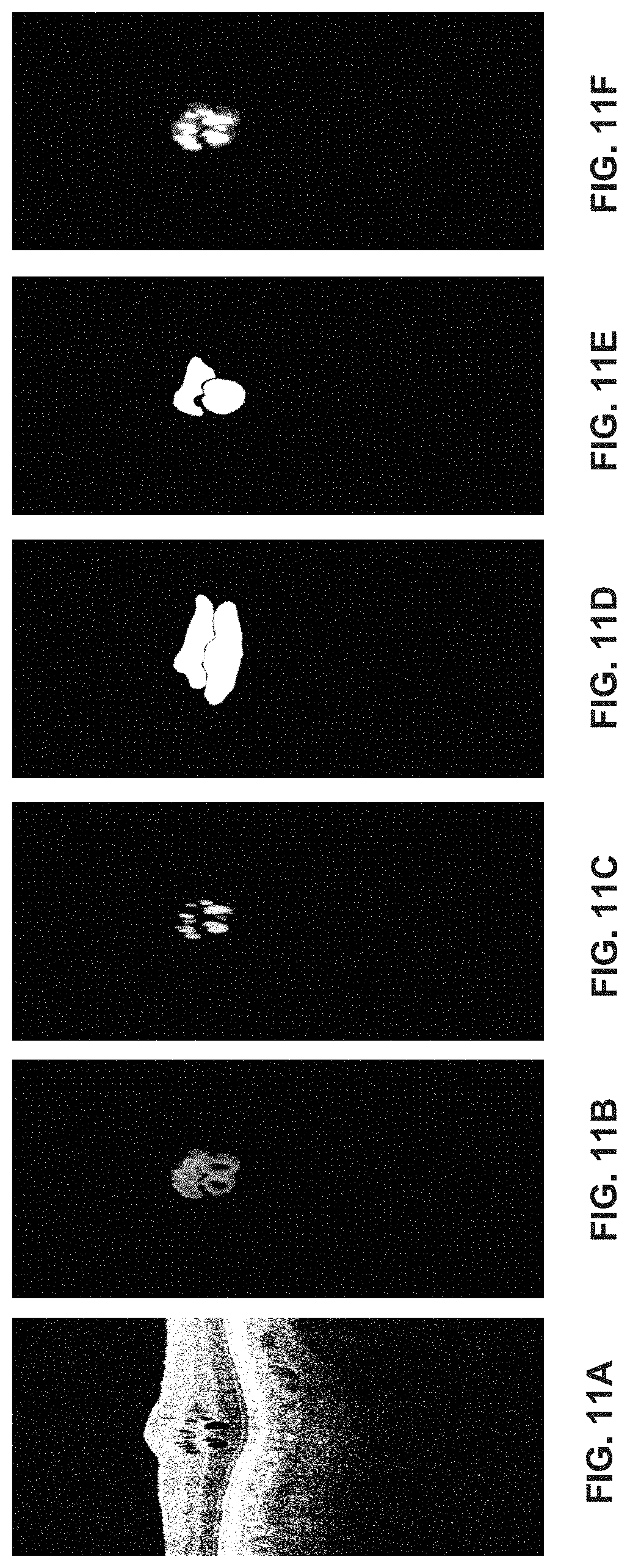 Patent US11776119 Figure 12 – Confidence-based method and system for analyzing images of a retina
