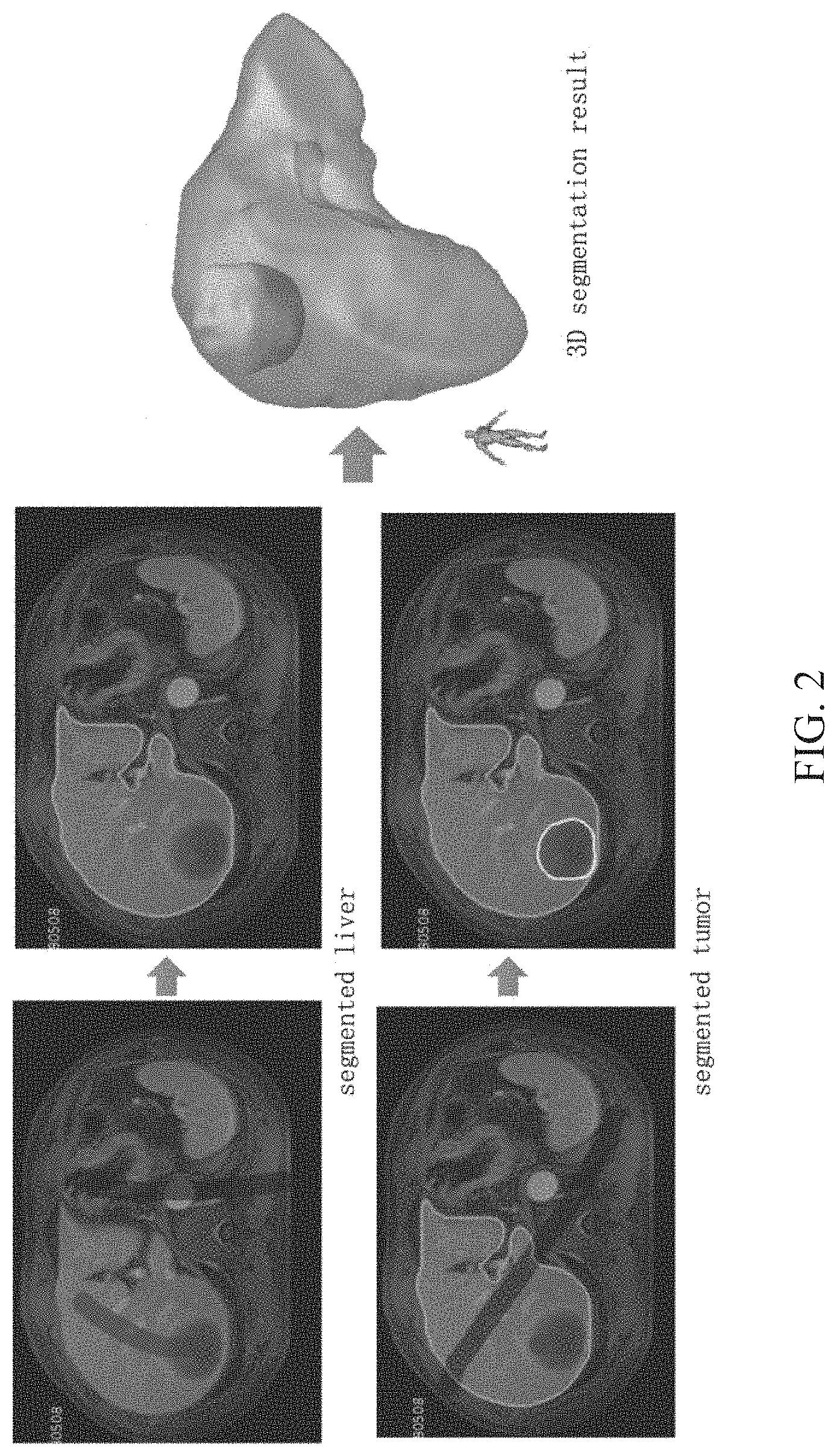 Patent US11776120 Figure 2 – Method for predicting morphological changes of liver tumor after ablation based on deep learning