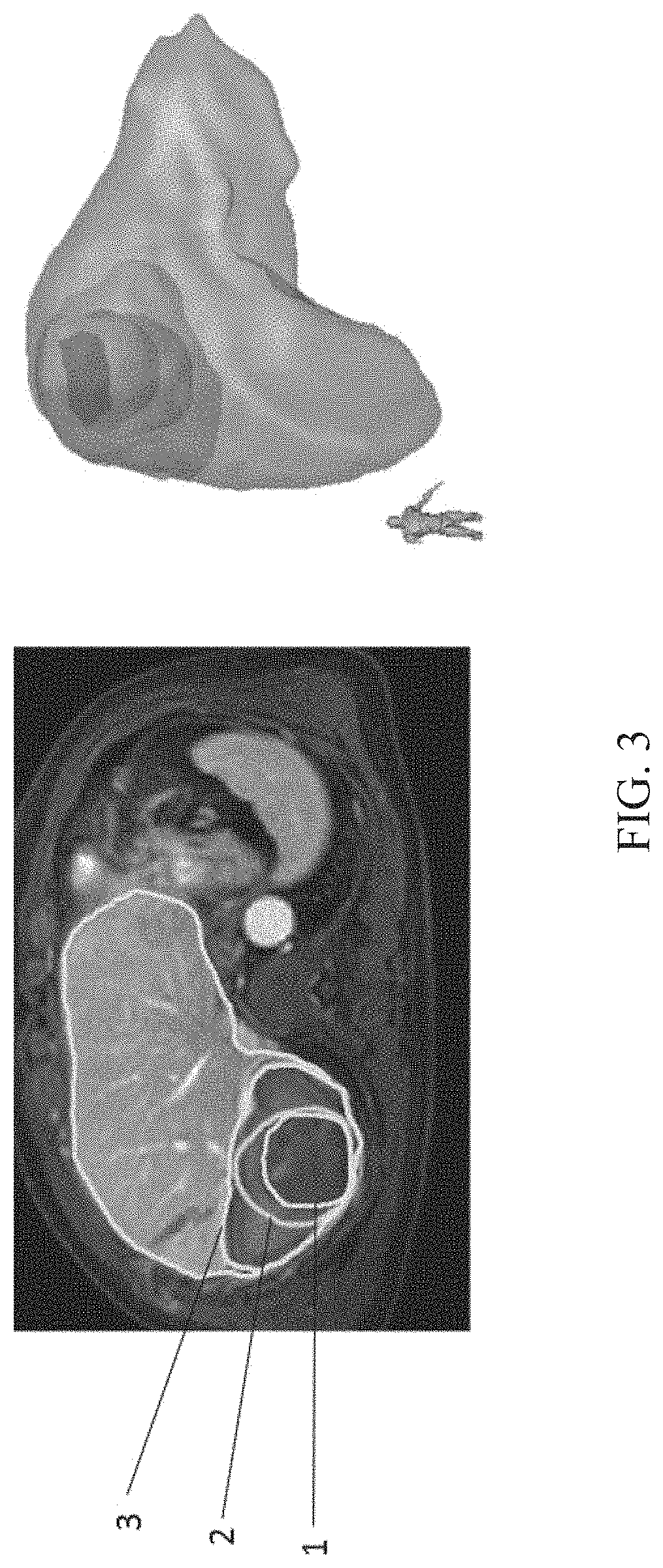 Patent US11776120 Figure 3 – Method for predicting morphological changes of liver tumor after ablation based on deep learning