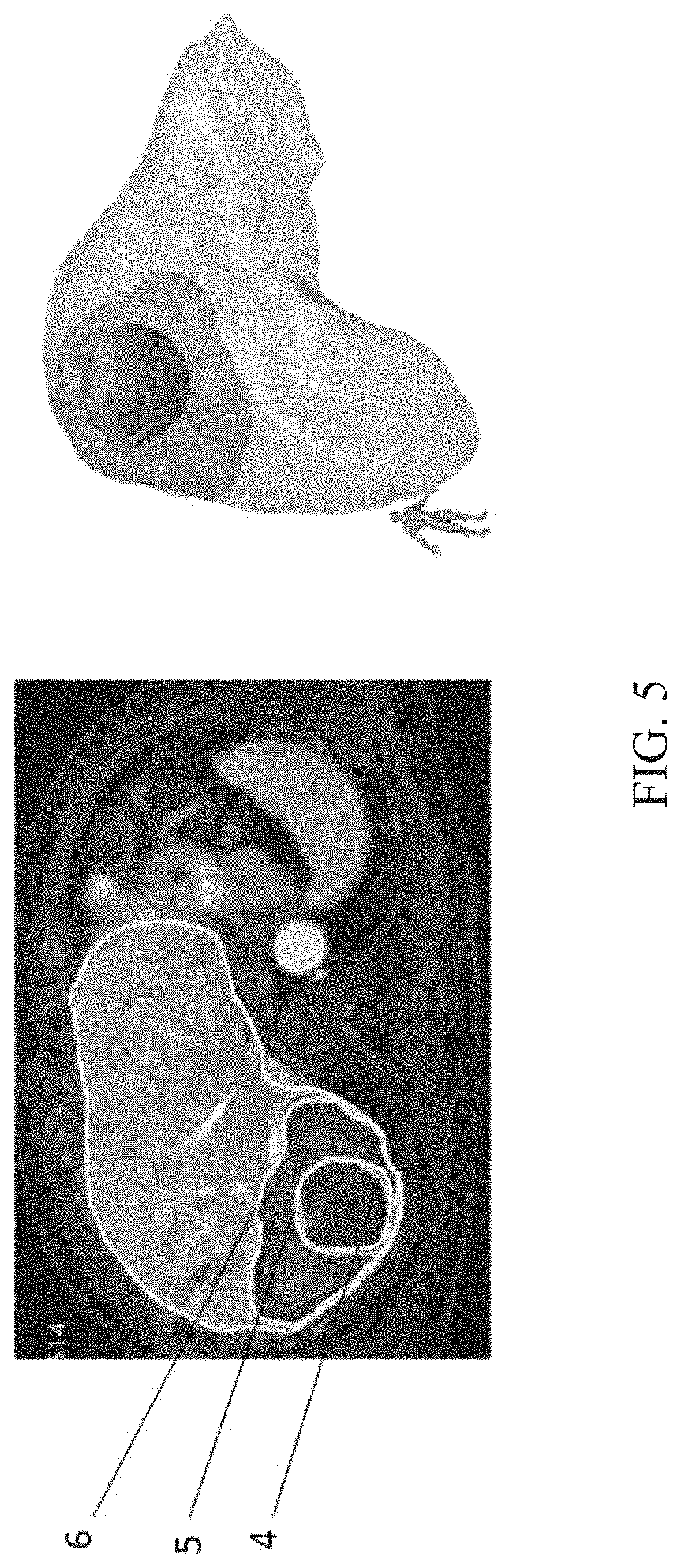 Patent US11776120 Figure 5 – Method for predicting morphological changes of liver tumor after ablation based on deep learning
