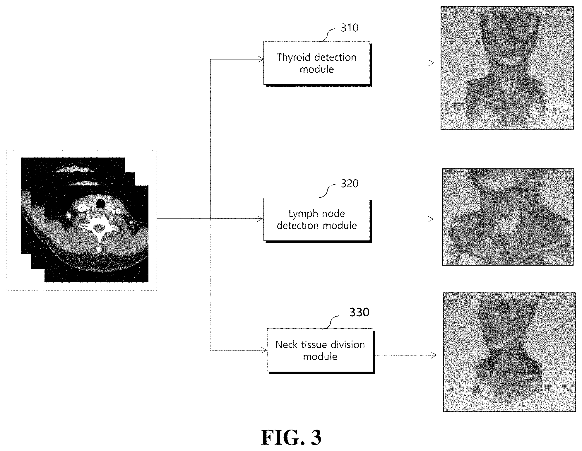 Patent US11776121 Figure 3 – Method and apparatus for providing information needed for diagnosis of lymph node metastasis of thyroid cancer