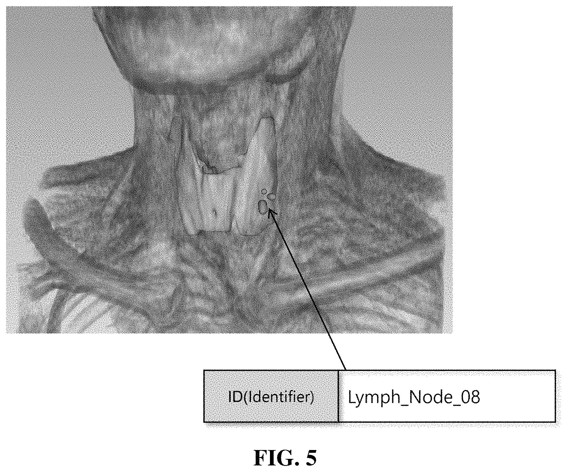 Patent US11776121 Figure 5 – Method and apparatus for providing information needed for diagnosis of lymph node metastasis of thyroid cancer