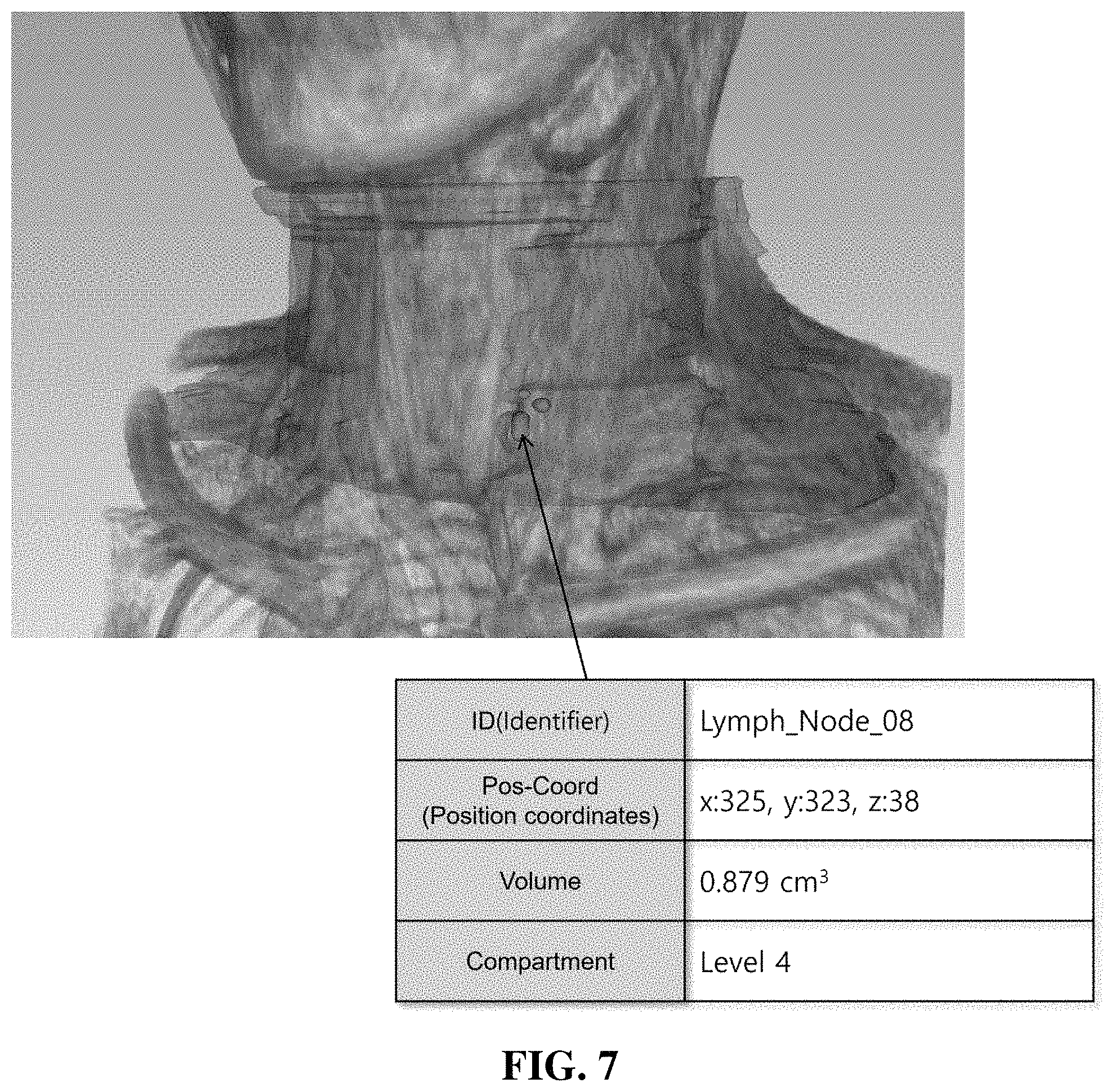 Patent US11776121 Figure 7 – Method and apparatus for providing information needed for diagnosis of lymph node metastasis of thyroid cancer