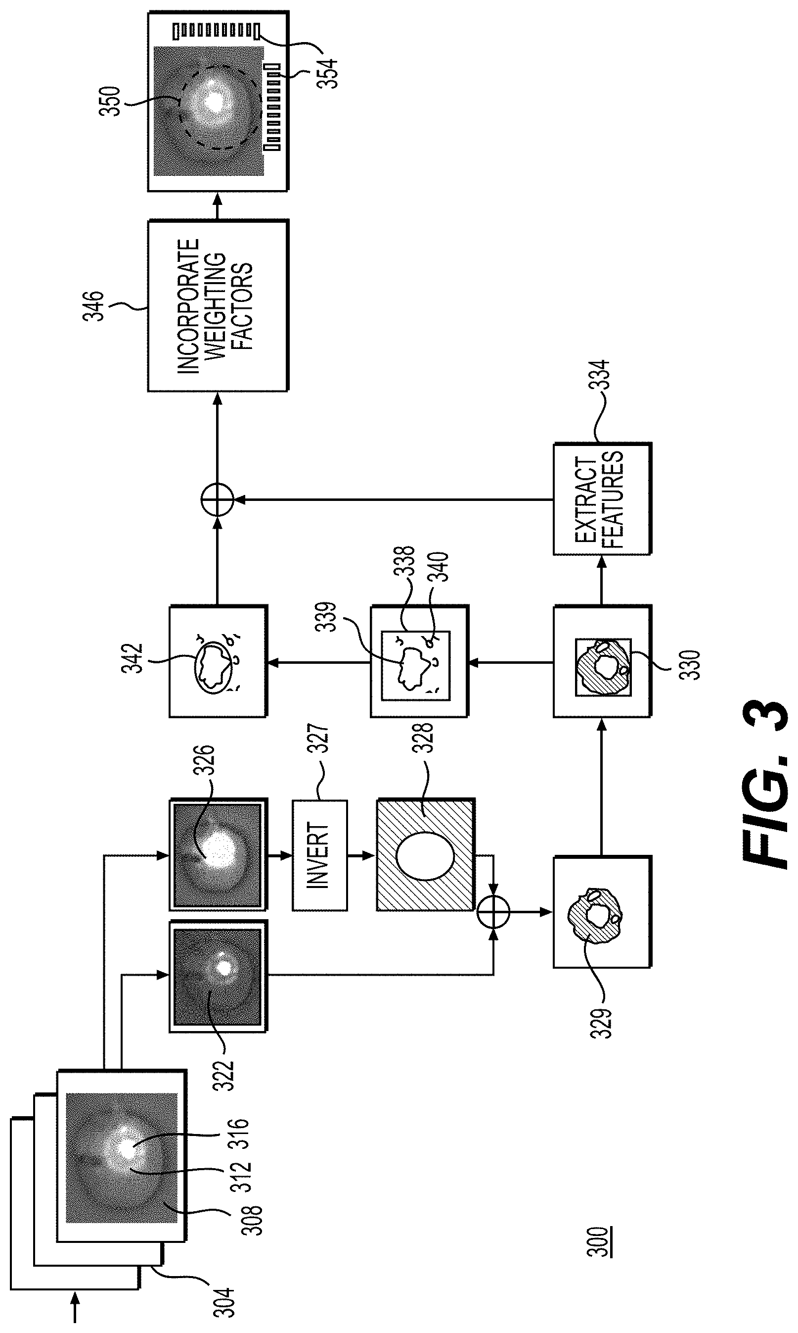 Patent US11776122 Figure 3 – Systems and methods for processing electronic medical images to determine enhanced electronic medical images