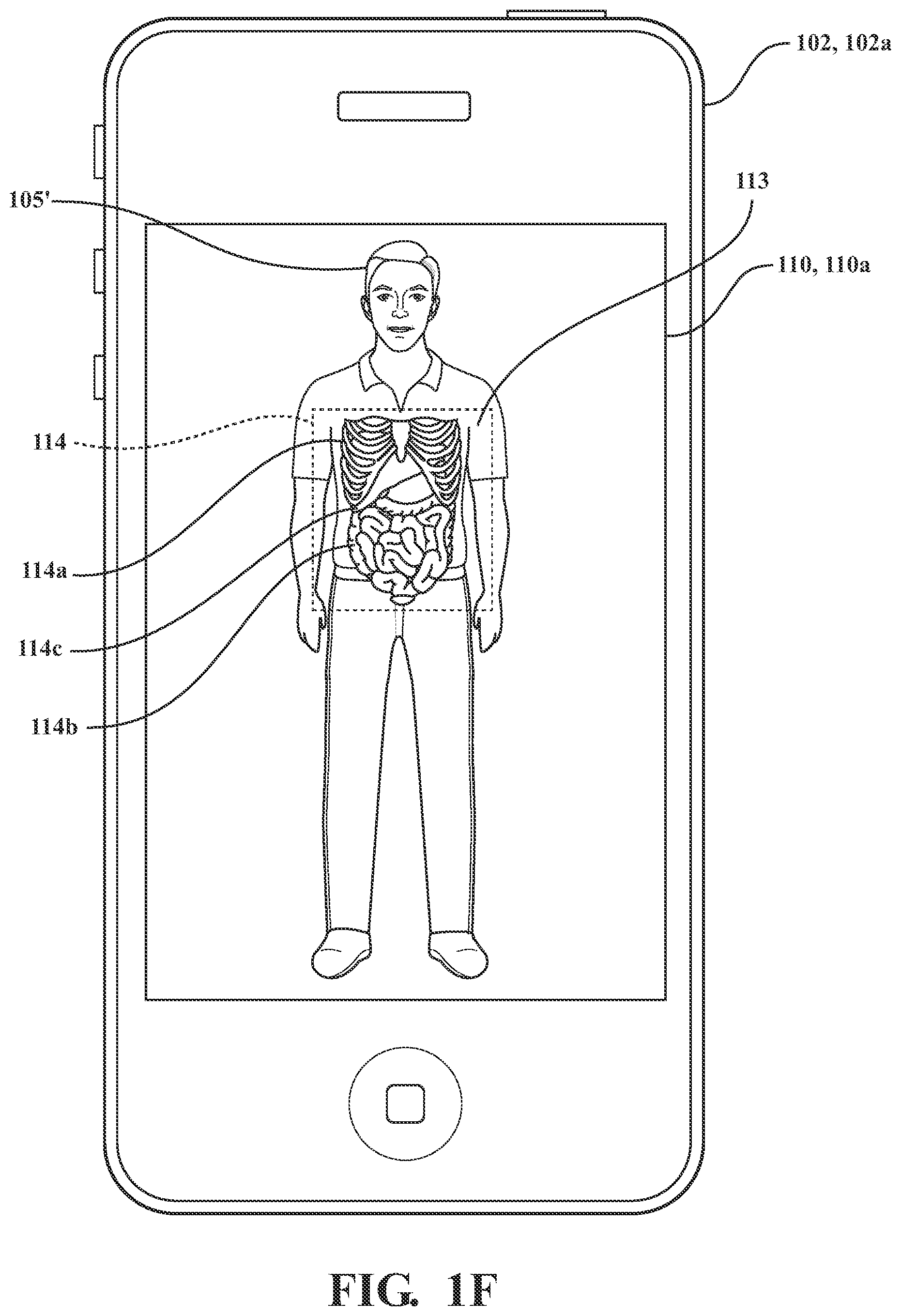 Patent US11776123 Figure 6 – Systems and methods for displaying augmented anatomical features