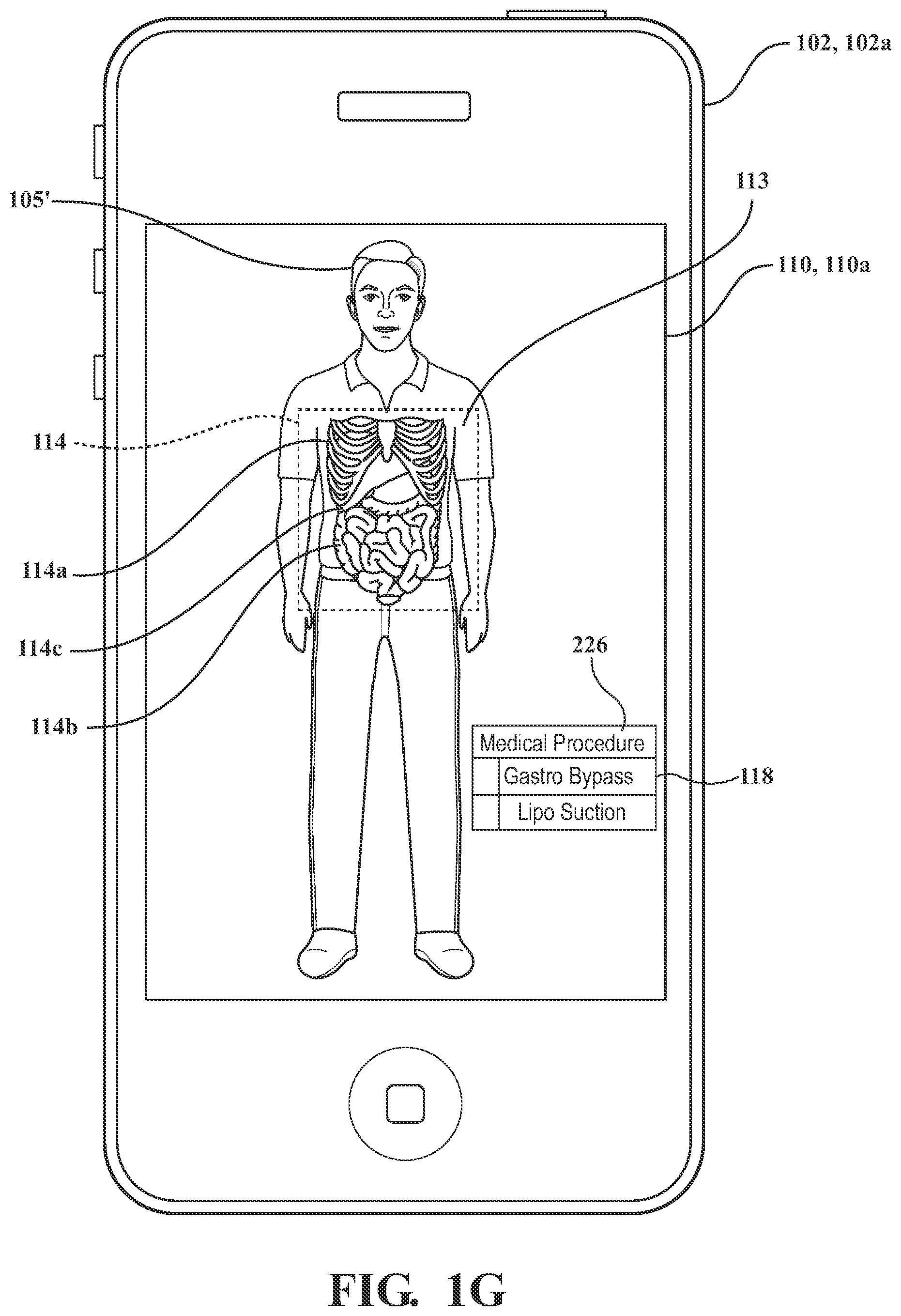 Patent US11776123 Figure 7 – Systems and methods for displaying augmented anatomical features