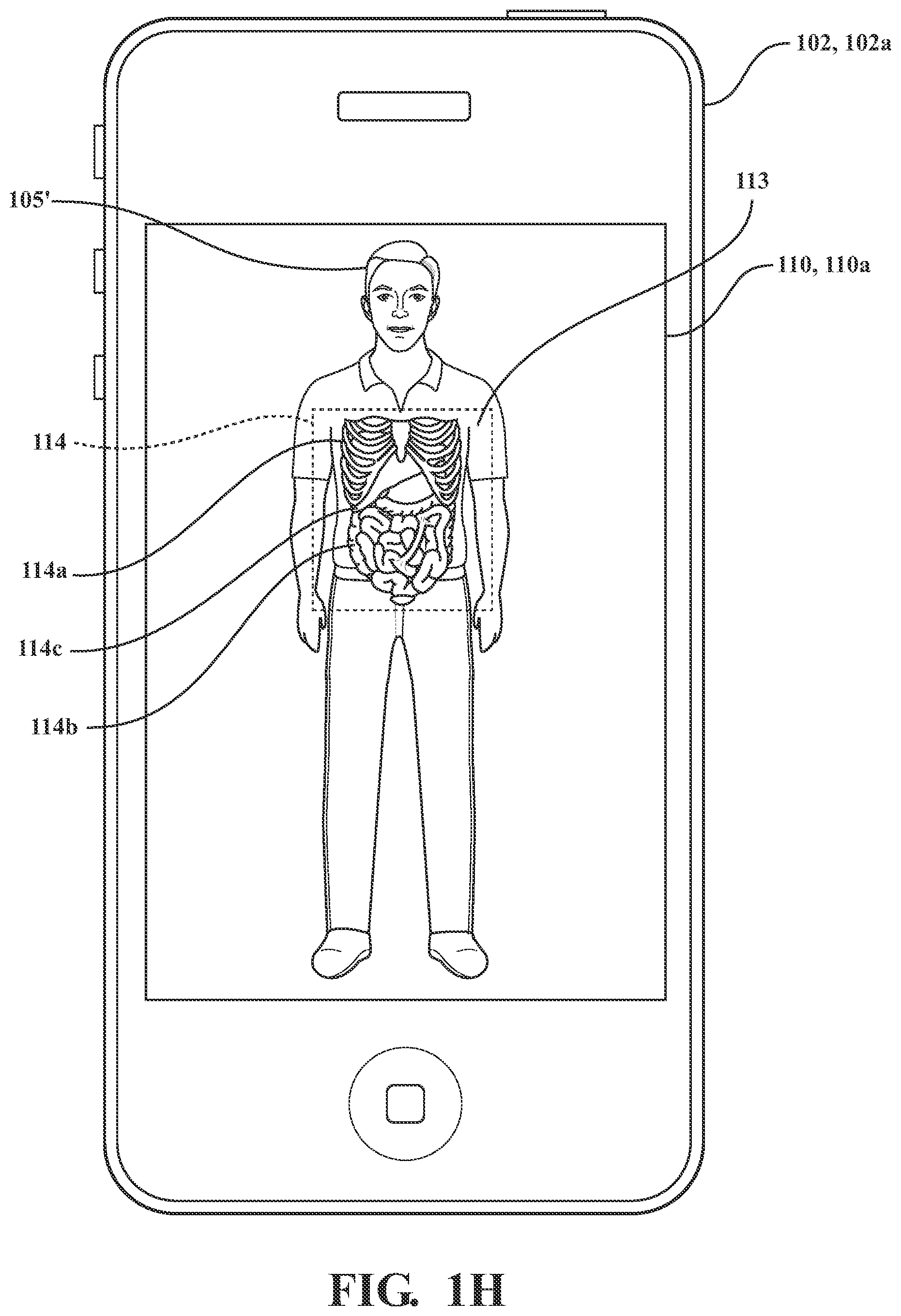 Patent US11776123 Figure 8 – Systems and methods for displaying augmented anatomical features